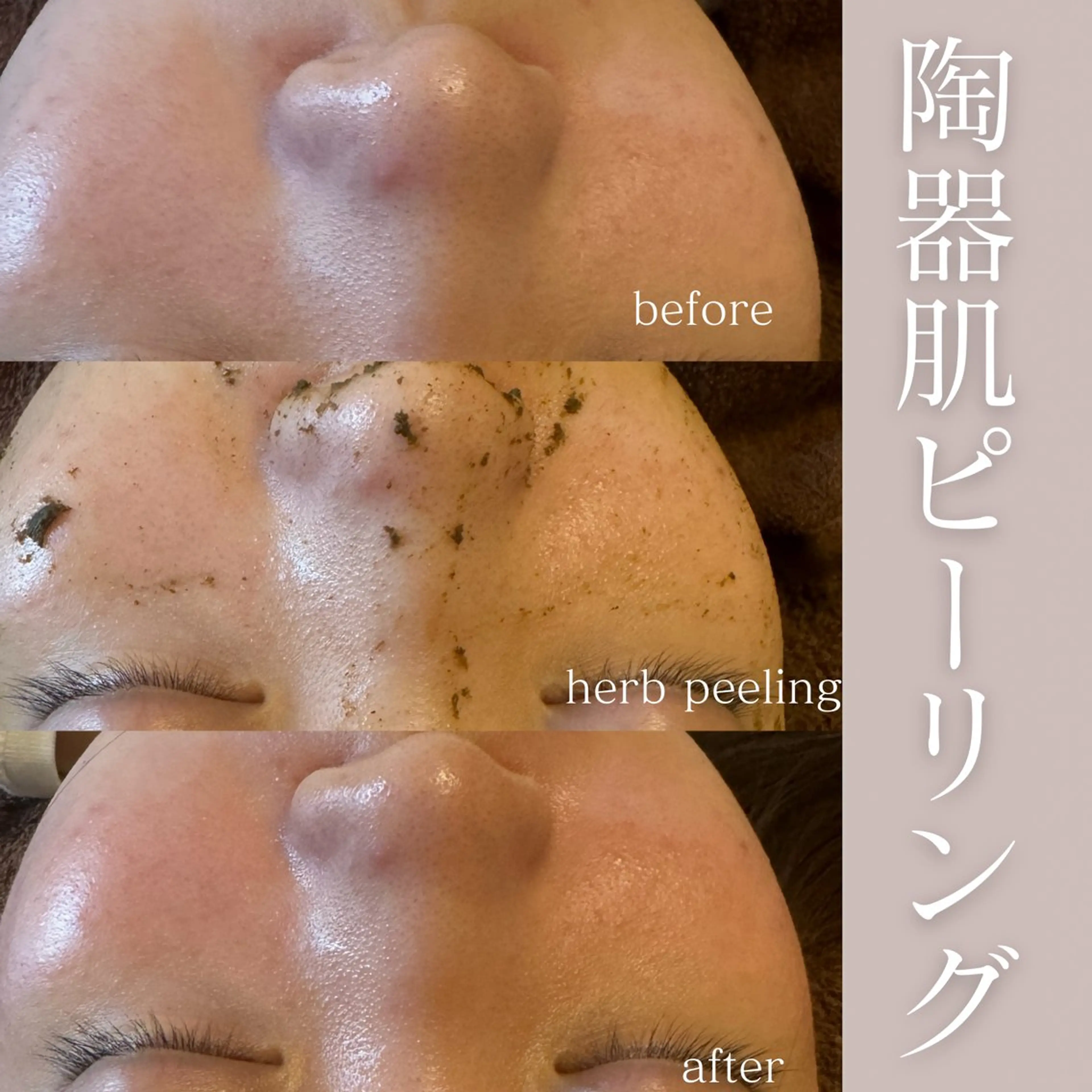 エステ 美肌salon GRAN CUORE所属・Natsuki🌙 GRAN CUOREのエステ・リラクイメージ