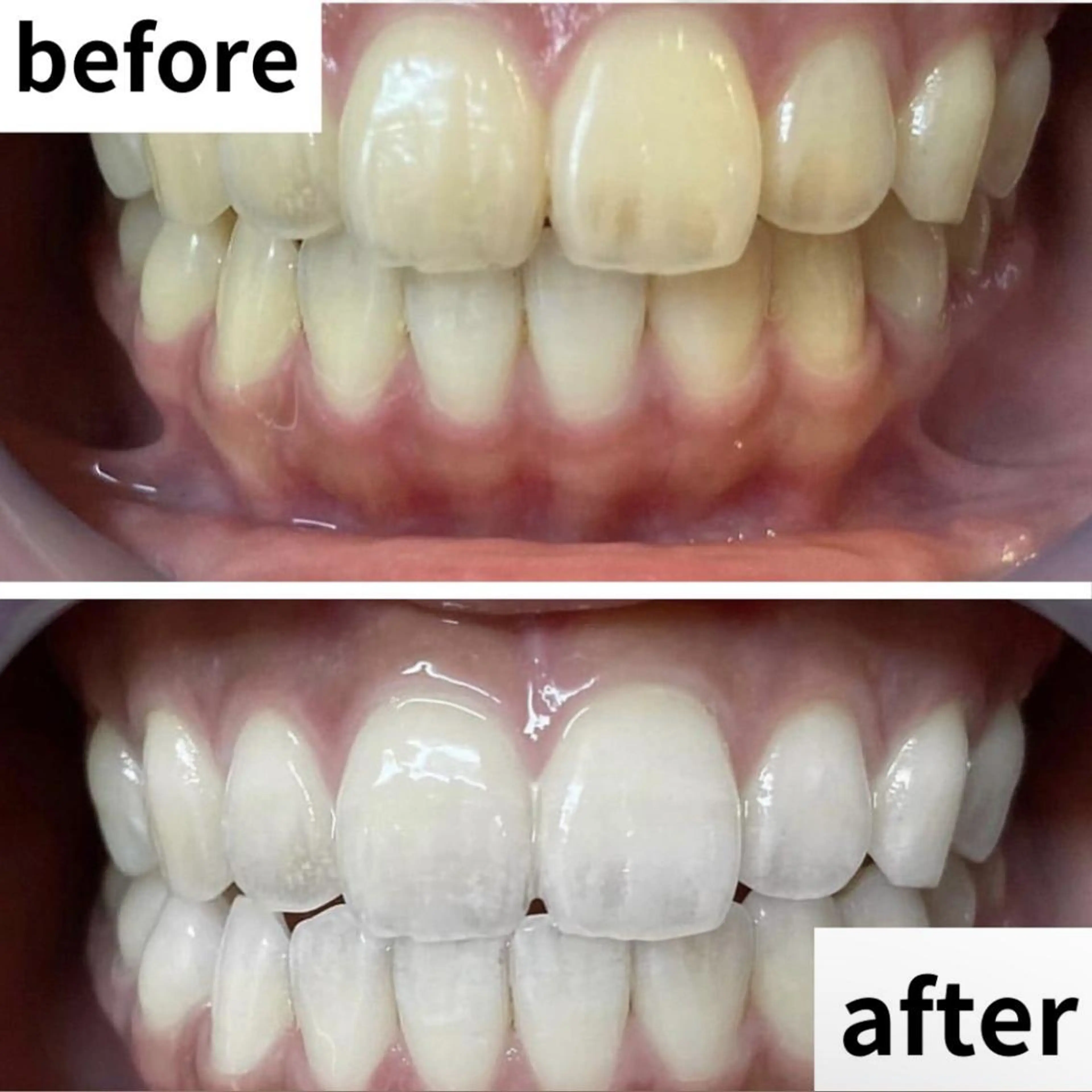 LBSホワイトニング 🌐渋谷店 小河原のエステ・リラクイメージ