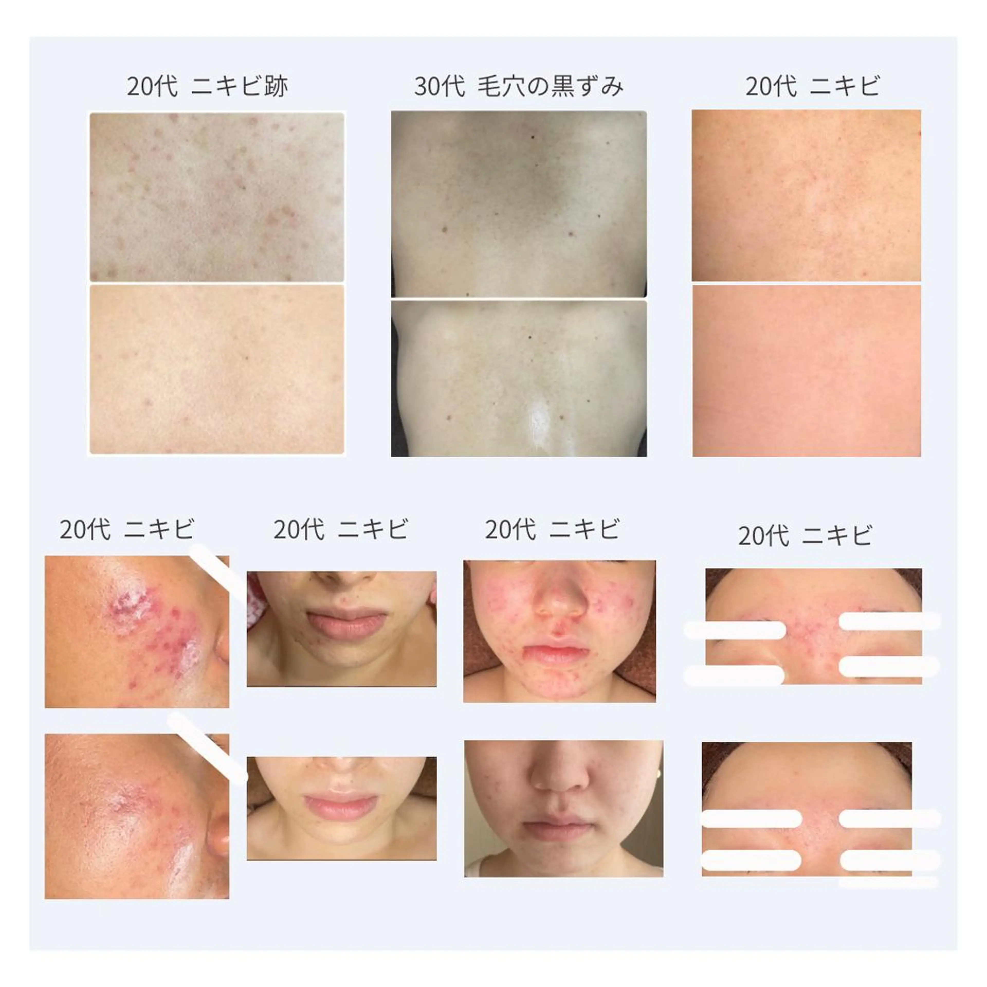 ベラージュ【美背中・ 美尻・フェイシャル】のエステ・リラクイメージ