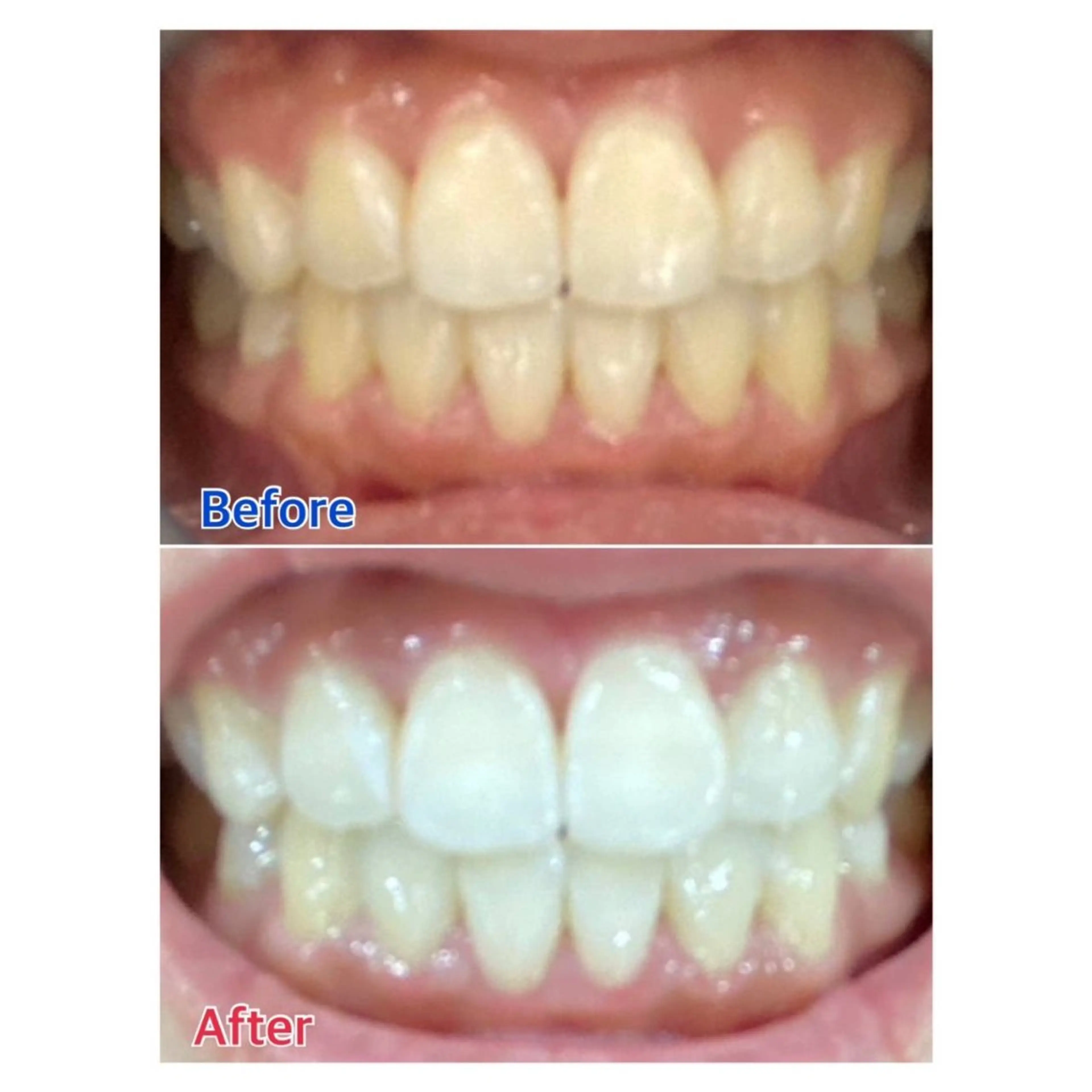 MBEAUTYSALON 千葉店・京成大久保所属・Melty 輝のその他イメージ