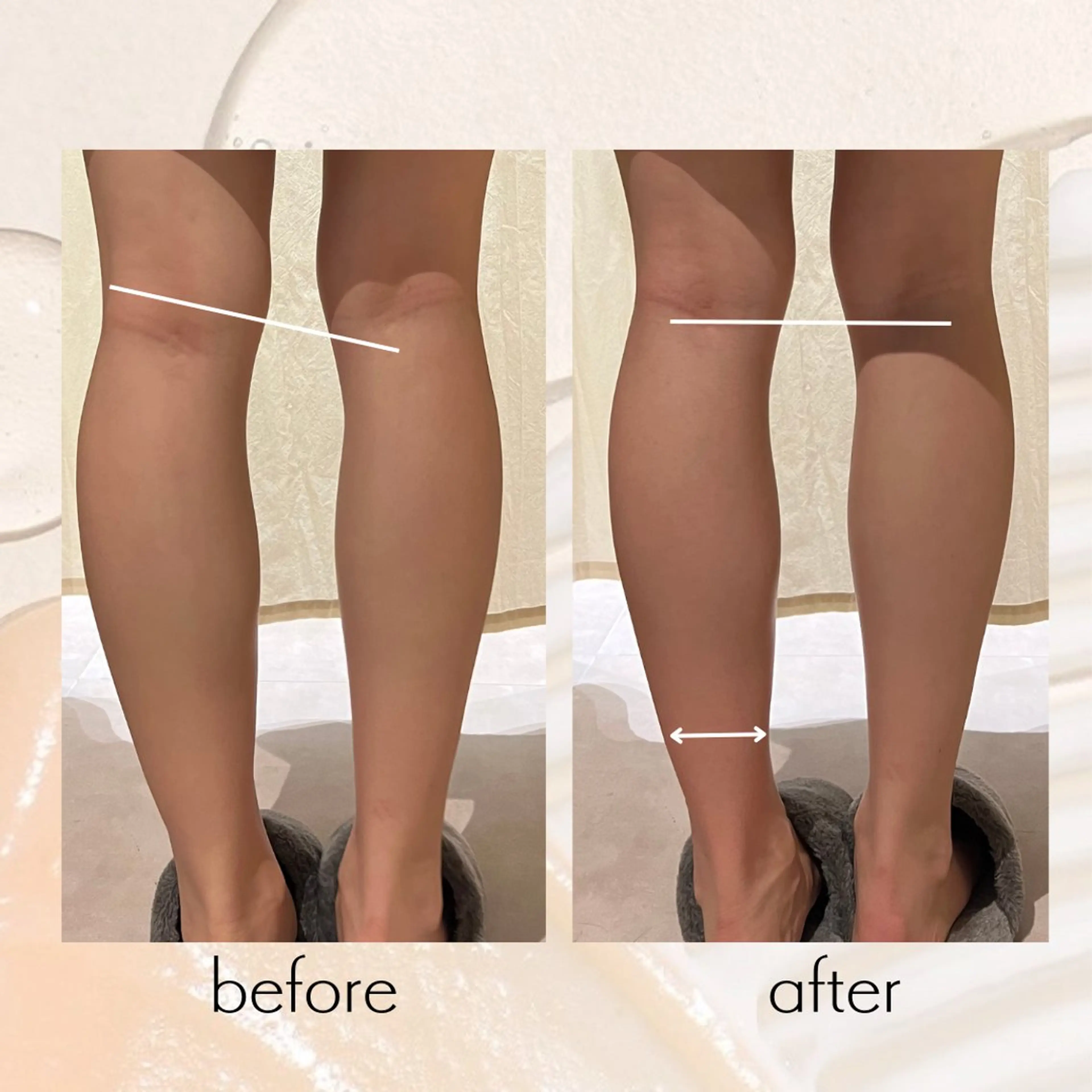 【vidyto】ヴィディトゥ所属・肌管理サロン vidyto　MOEのエステ・リラクイメージ