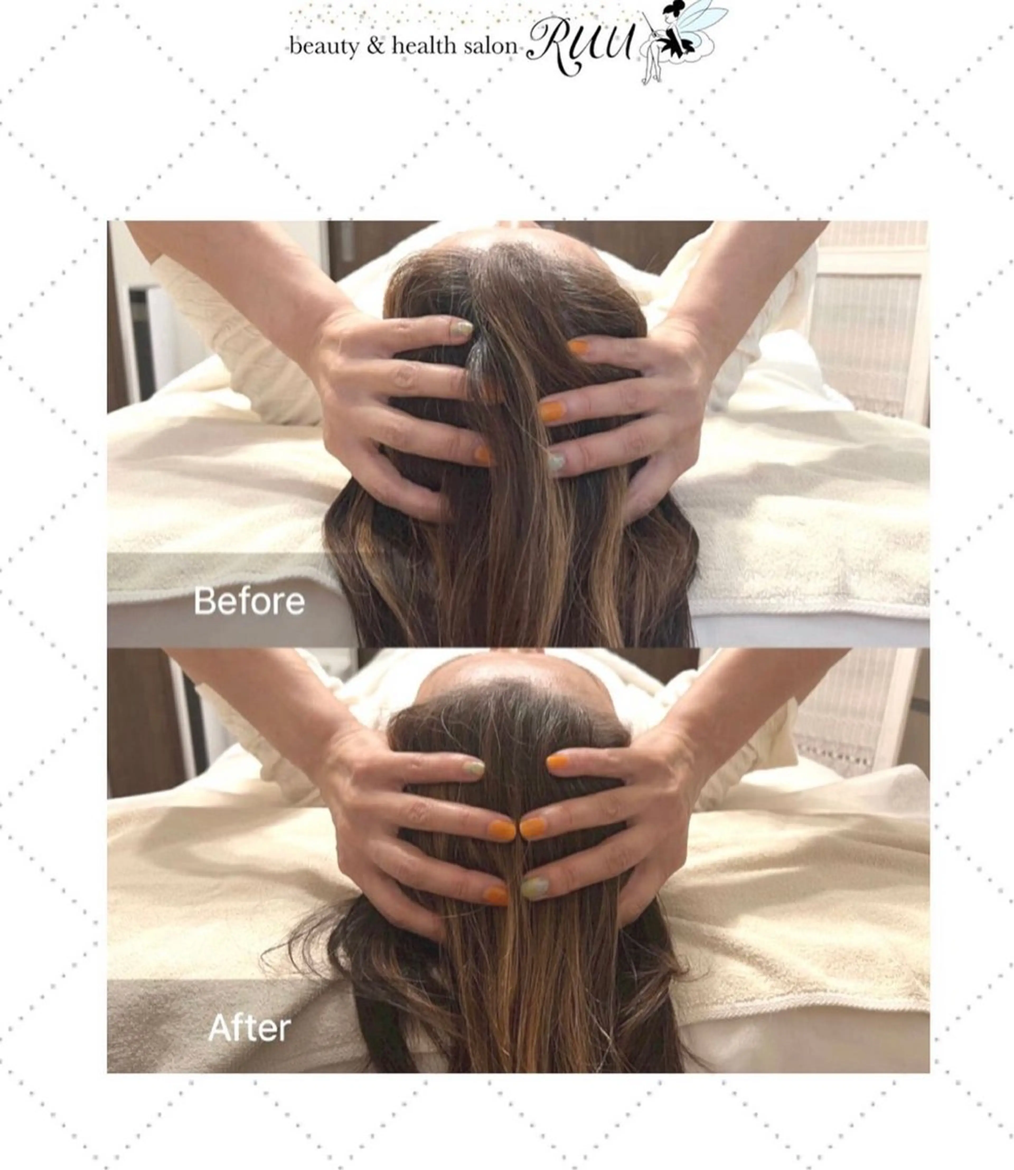 【頭痛、睡眠改善】 salon RUUのエステ・リラクイメージ