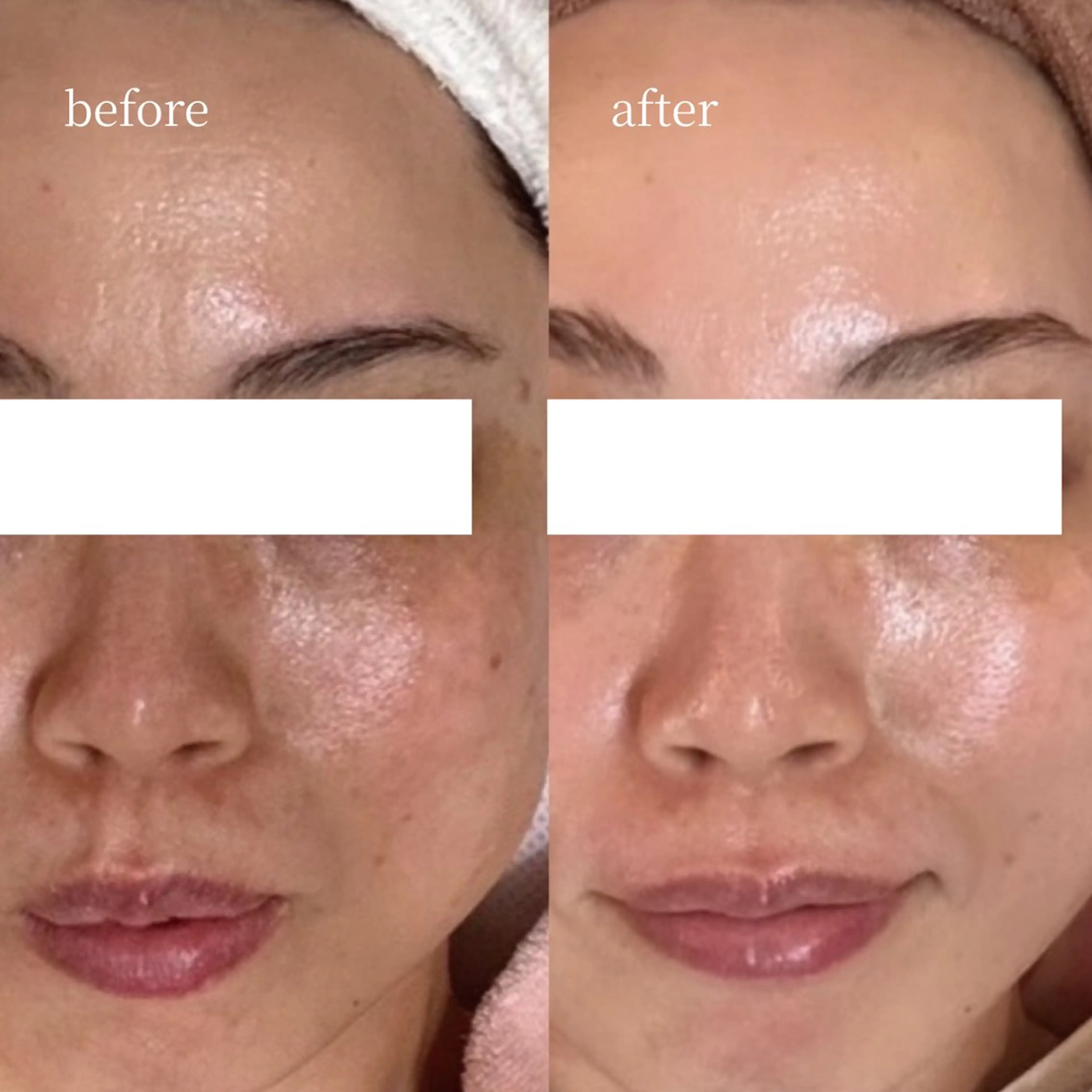 エステ 韓国肌管理・肌質改善 EARNEST心斎橋のエステ・リラクイメージ