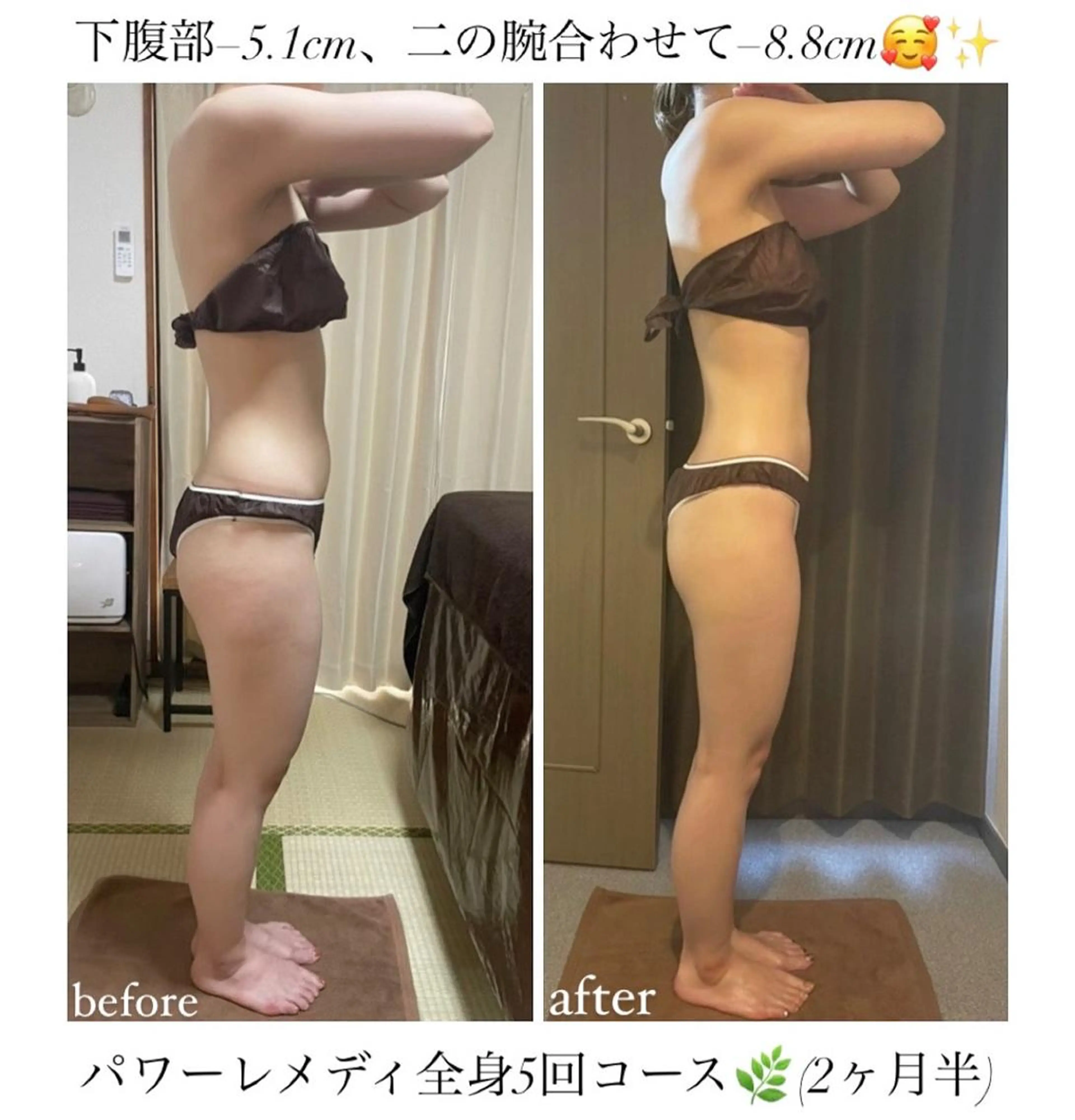 biloop所属・《本気痩せ×疲労改善 》  BILOOPのエステ・リラクイメージ