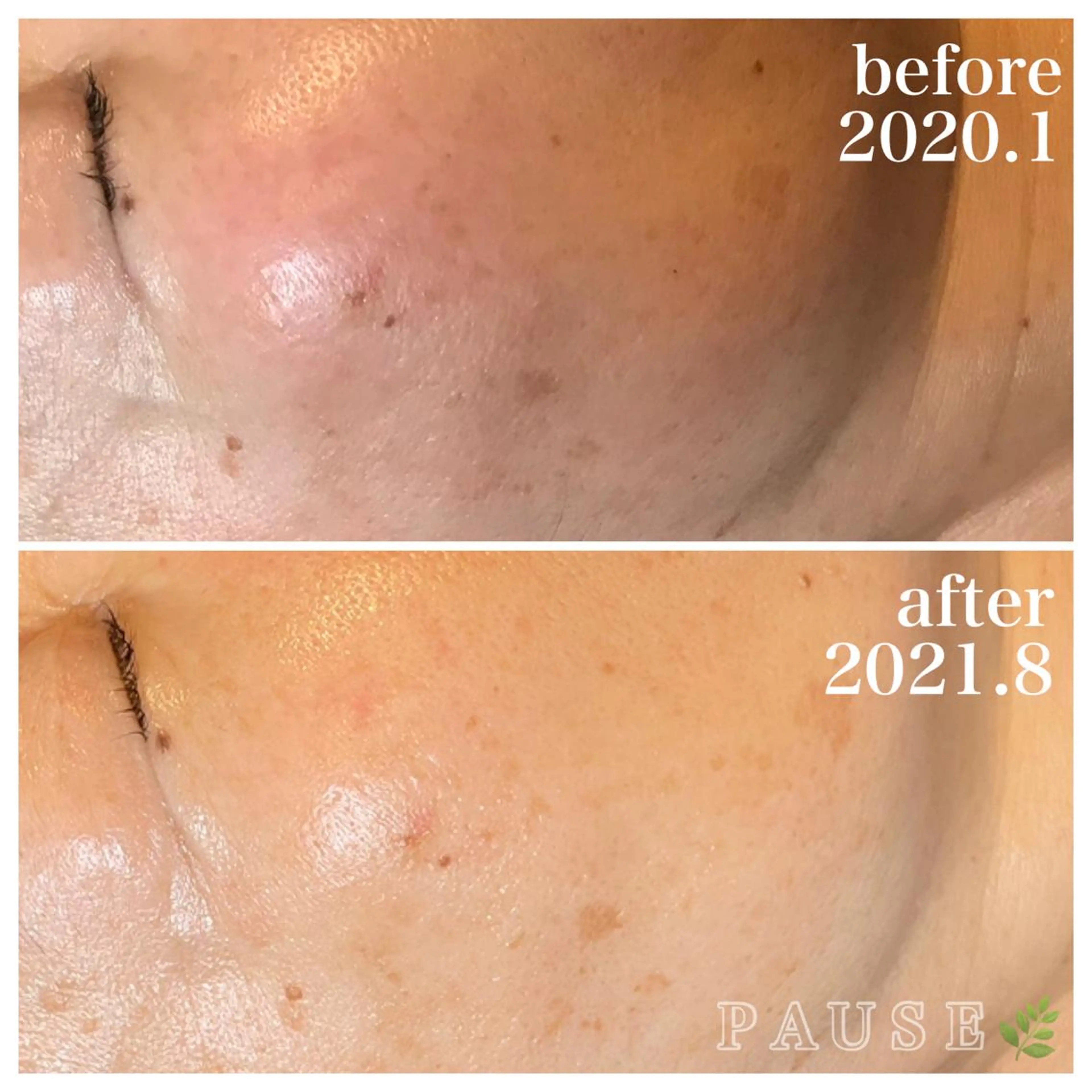 エステ 浜野 恵美のエステ・リラクイメージ