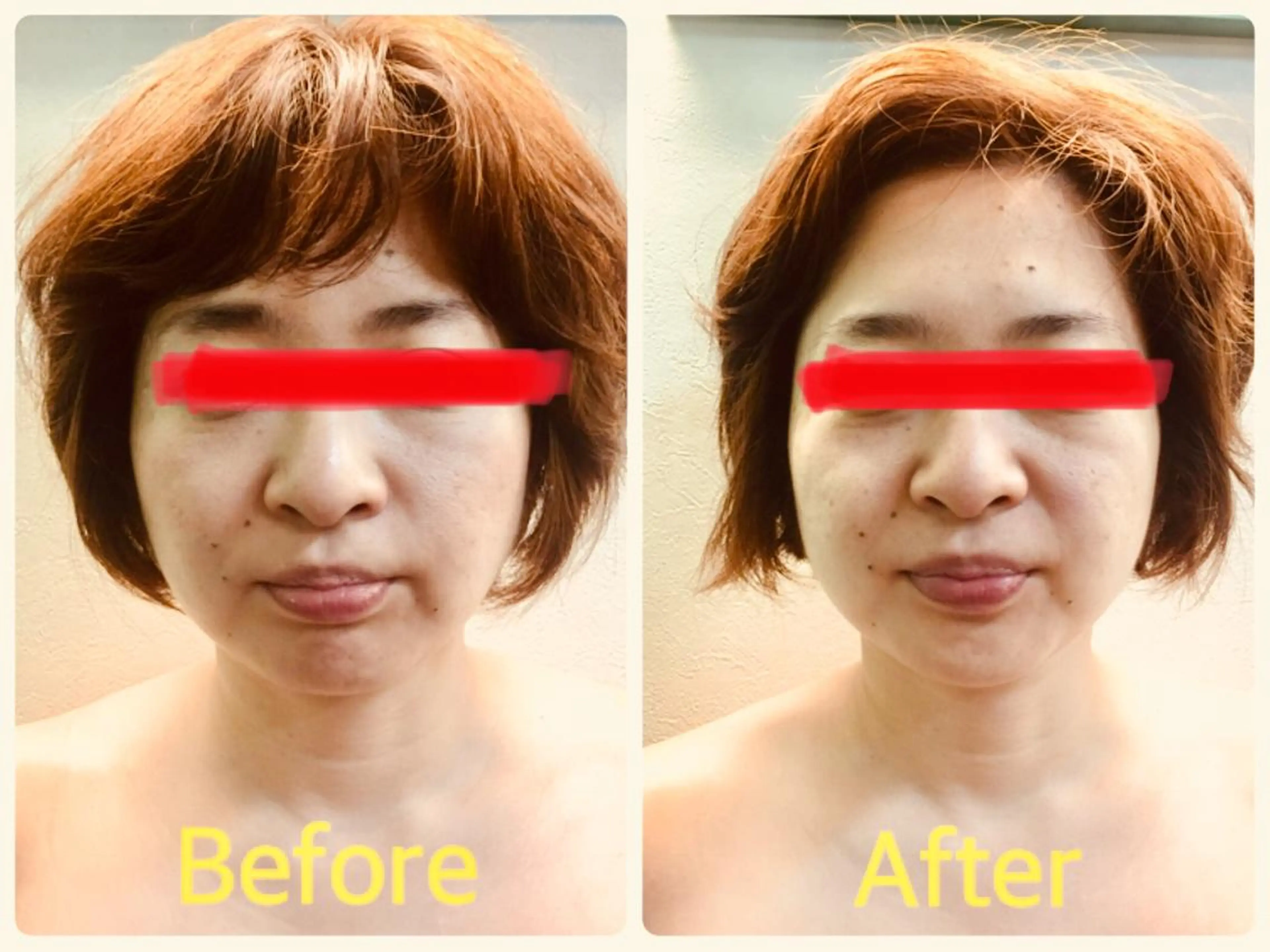 DeCoLé Beauty所属・艶肌/敏感肌/若さ/ ボディ痩身🌿のエステ・リラクイメージ