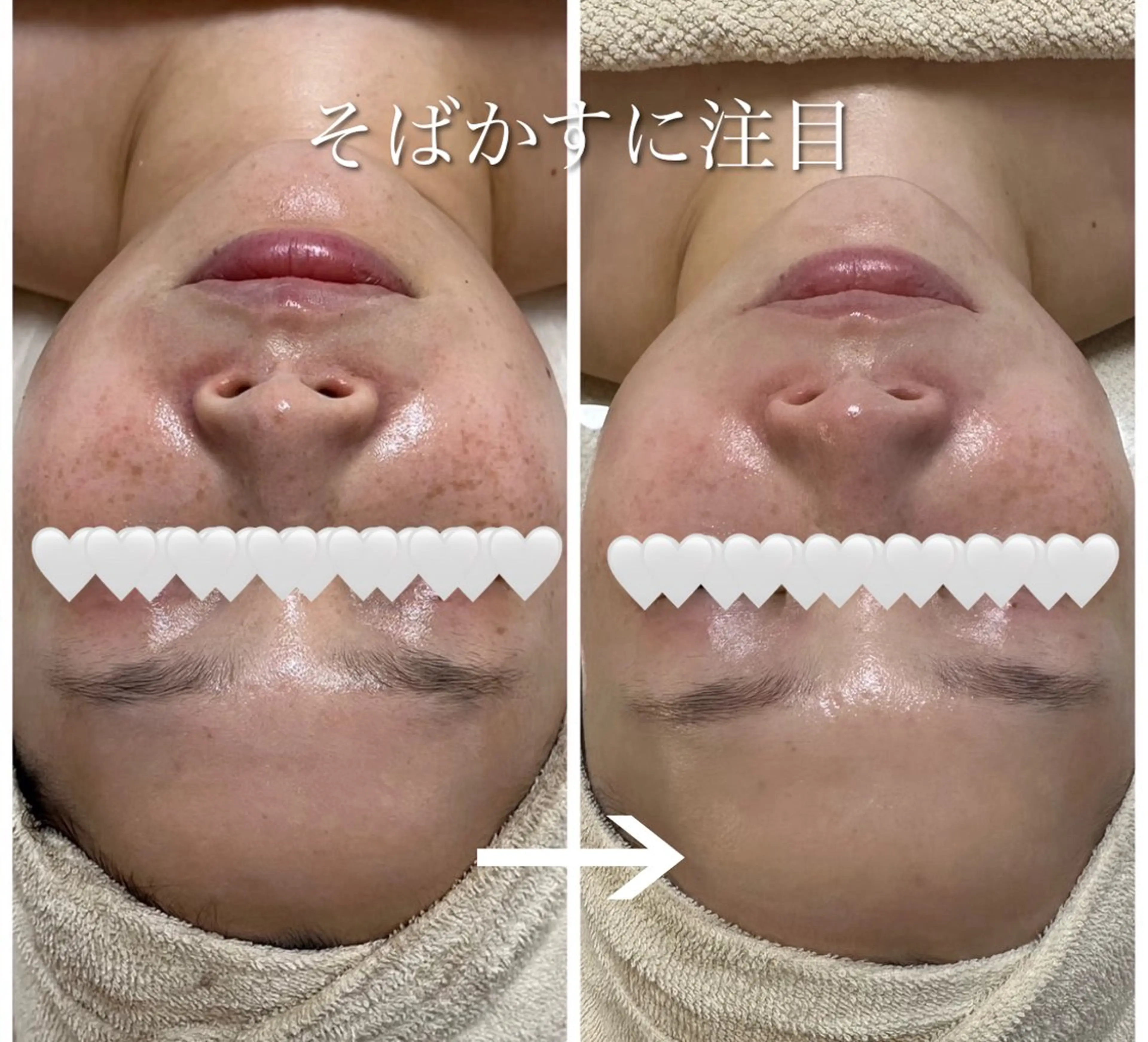 MELIA the beauty所属・肌のお悩み改善サロン MELIA/朋美のエステ・リラクイメージ