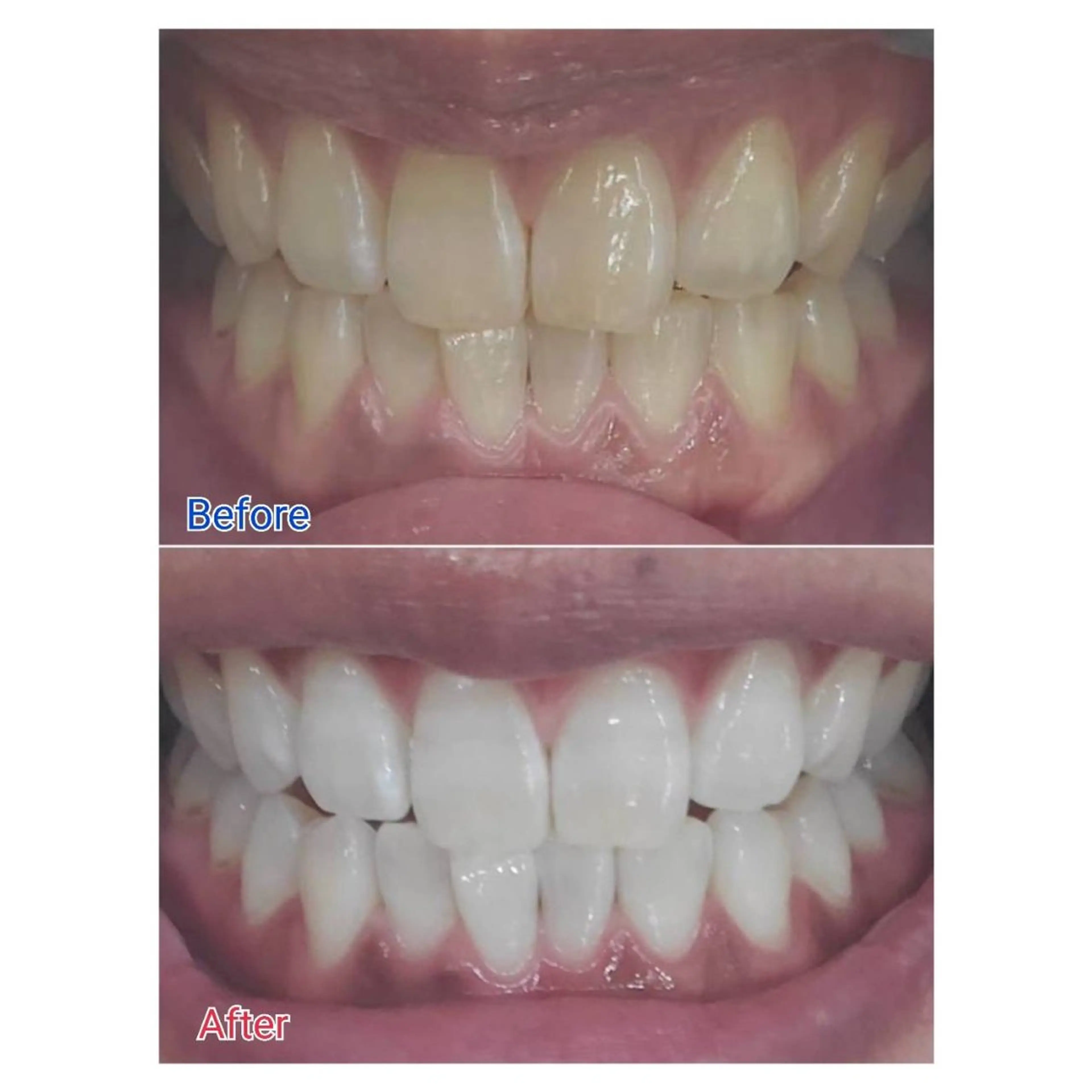 MBEAUTYSALON 千葉店・京成大久保所属・Melty 輝のその他イメージ