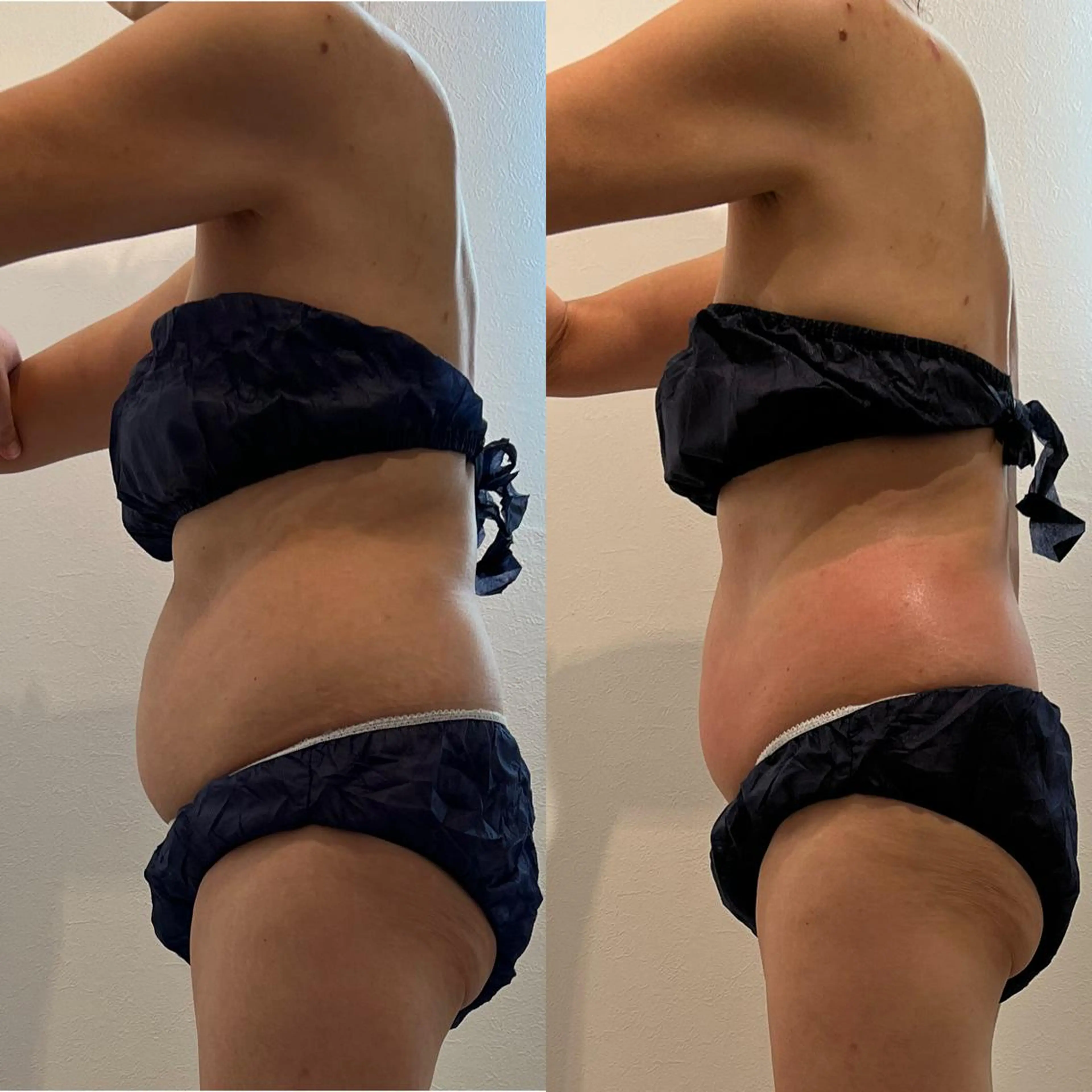 Reveur所属・Reveur REMIのエステ・リラクイメージ