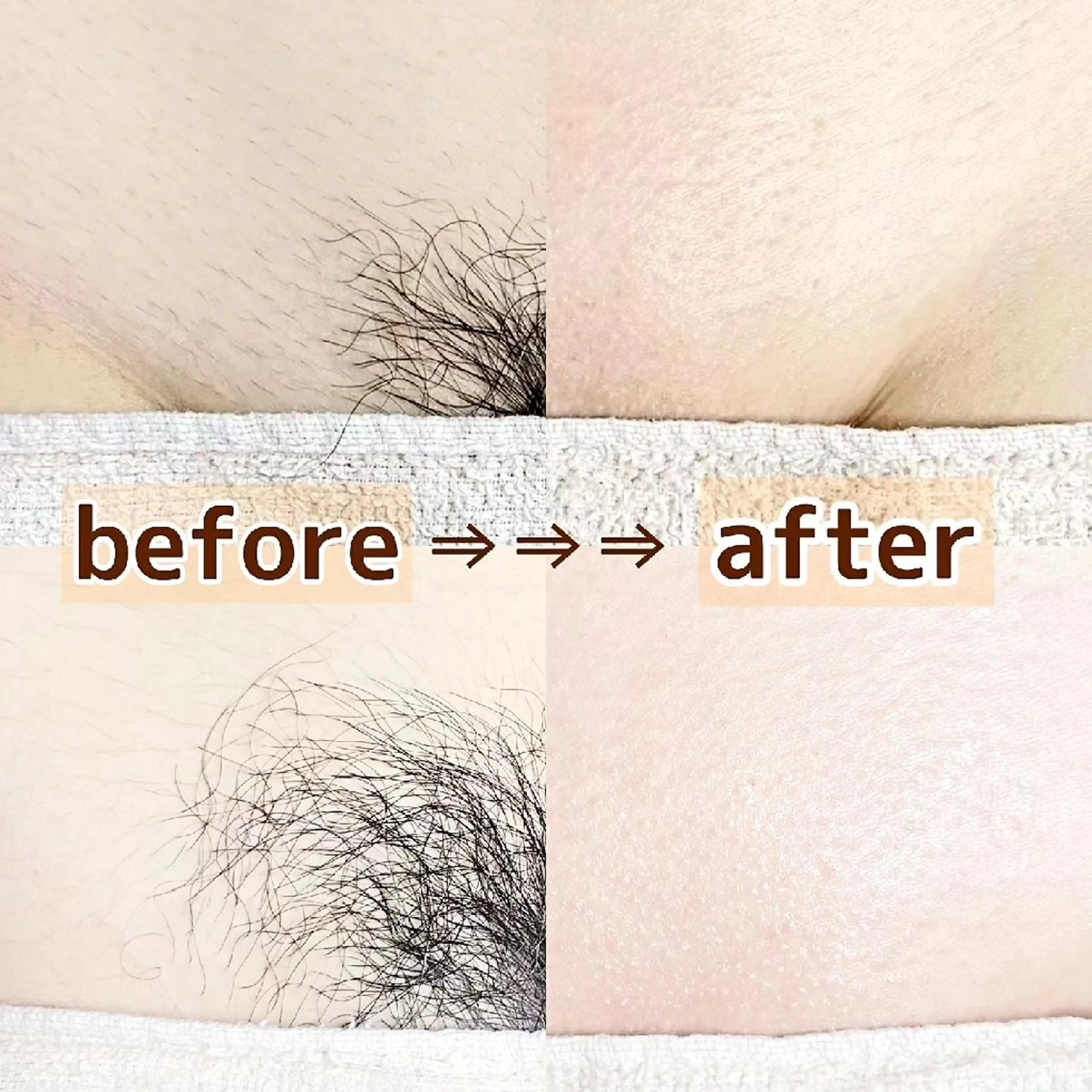 【モニター様価格】うなじ+顔シュガーリング🍋の写真