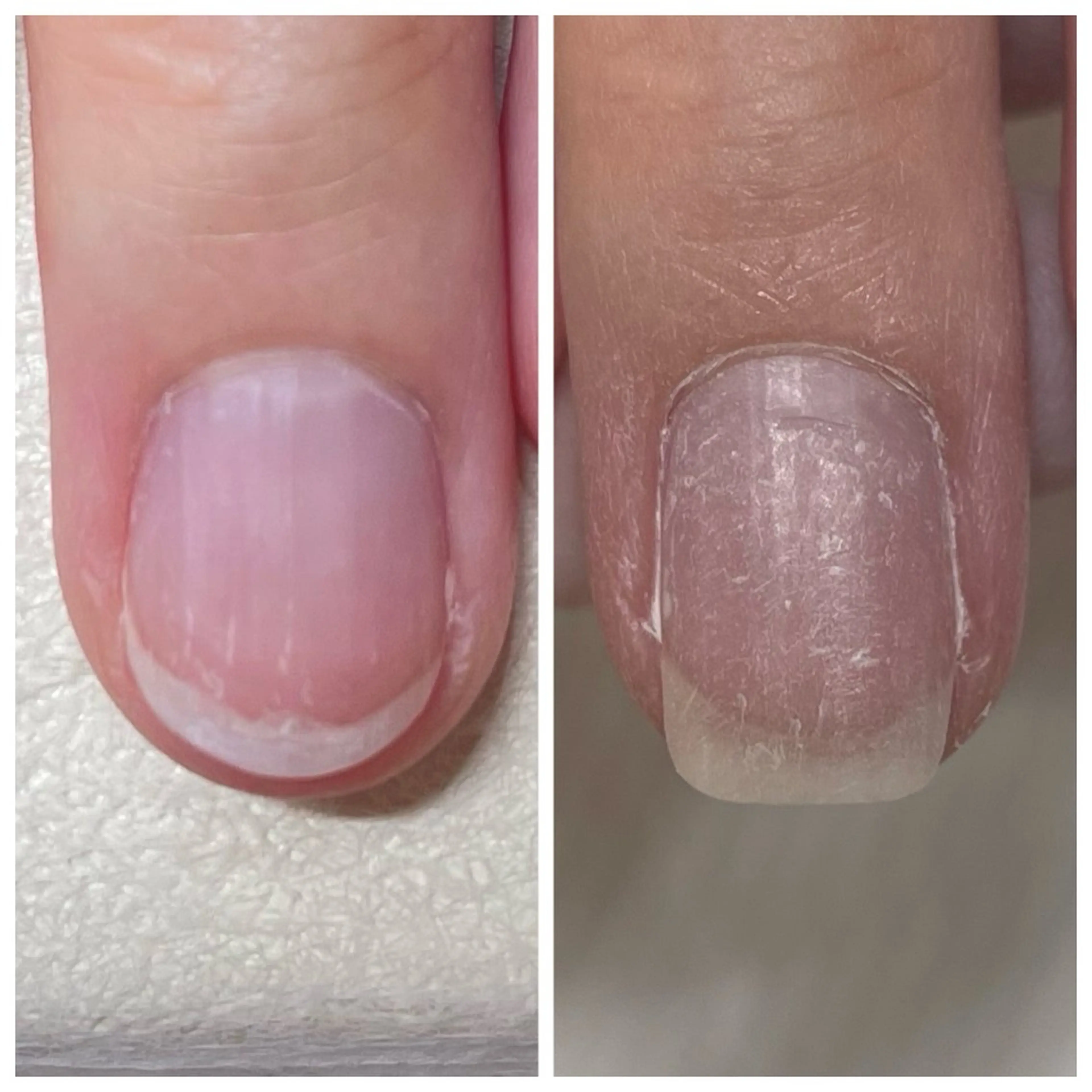 爪を綺麗に伸ばしたい方へ◎【ジェルを使った自爪育成モニター募集】※オフなしの方限定の写真