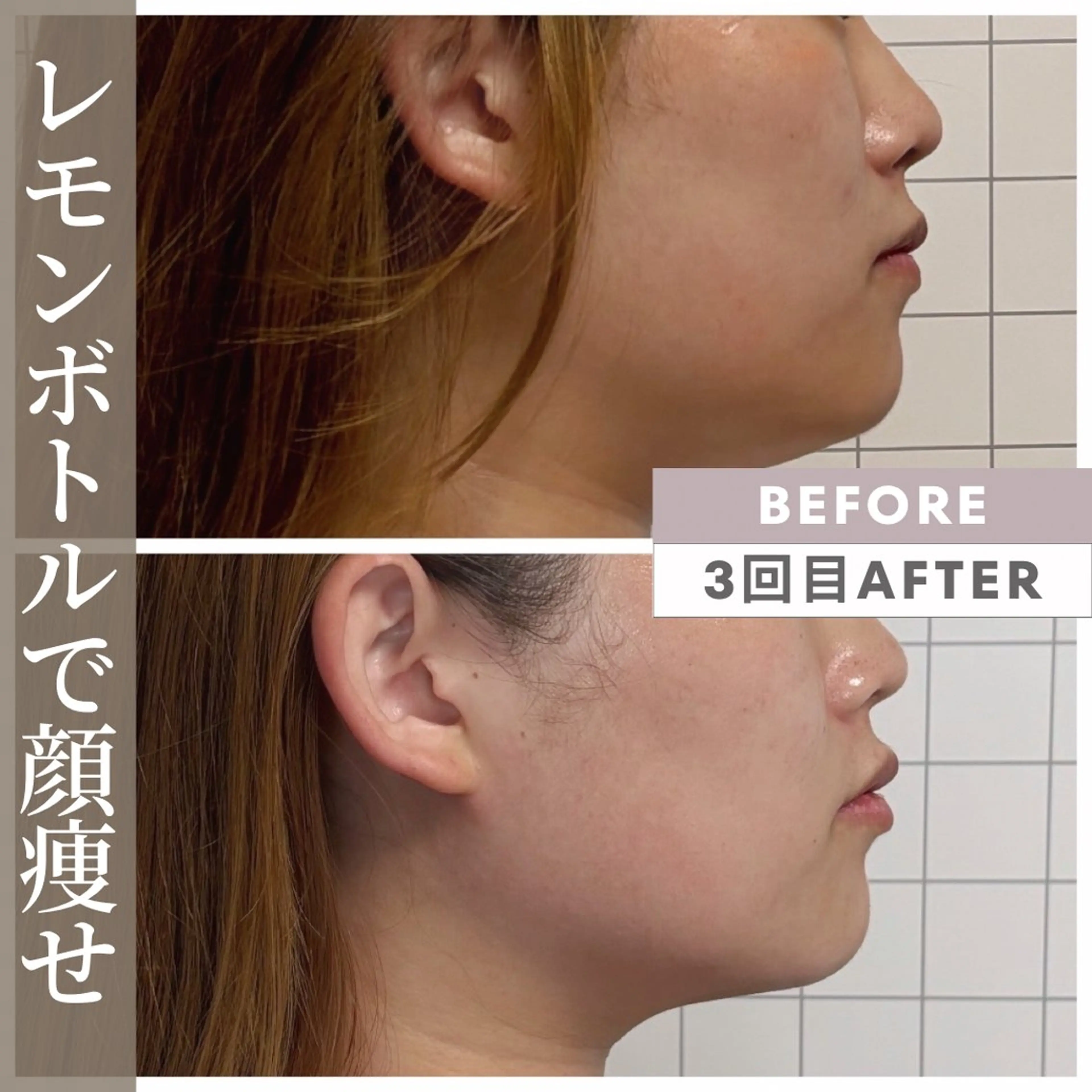 エステ リラク 小顔矯正専門店 【RED】池田のエステ・リラクイメージ