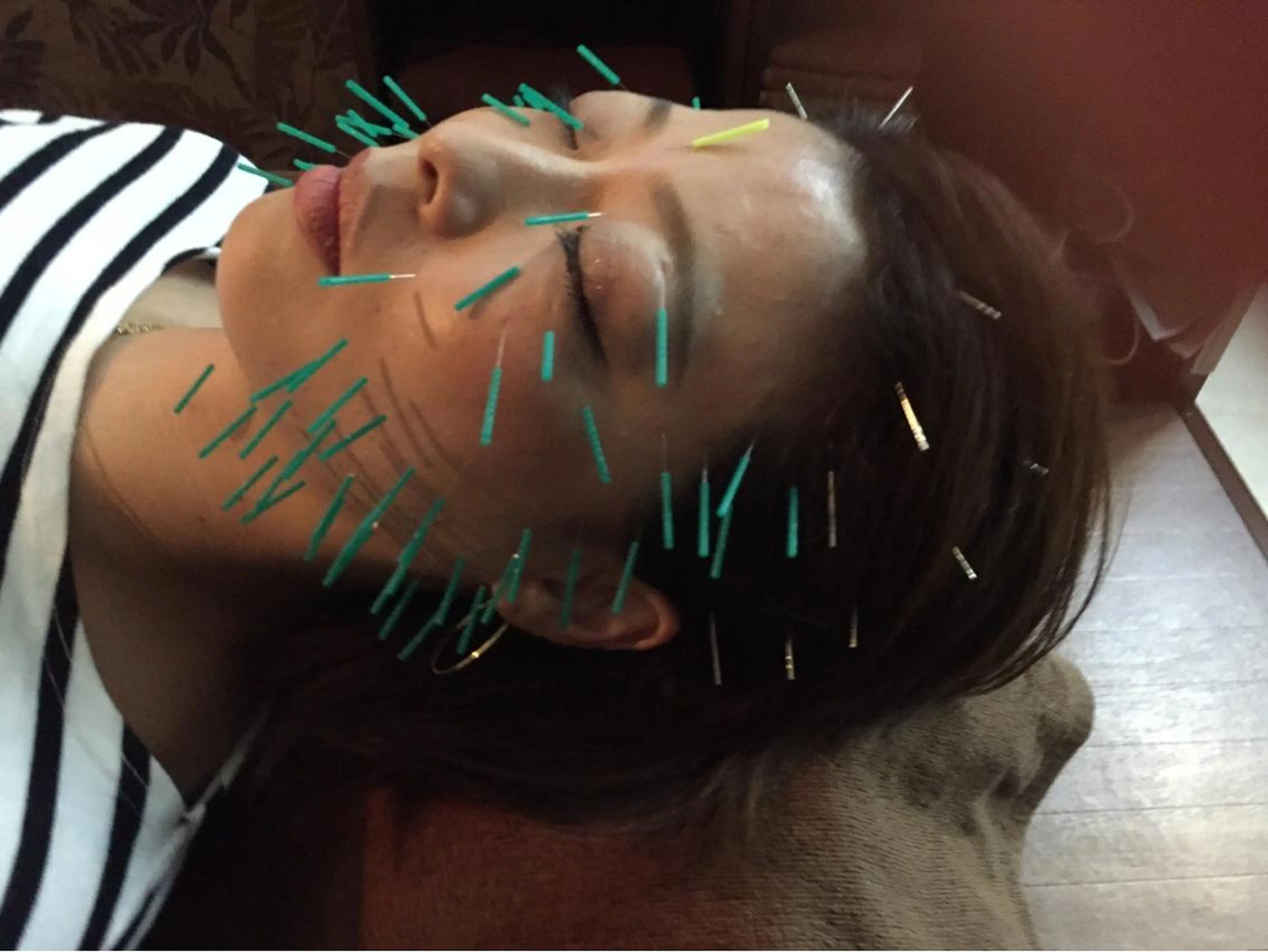 エステ リラク 美容鍼灸イロドリ  のエステ・リラクイメージ