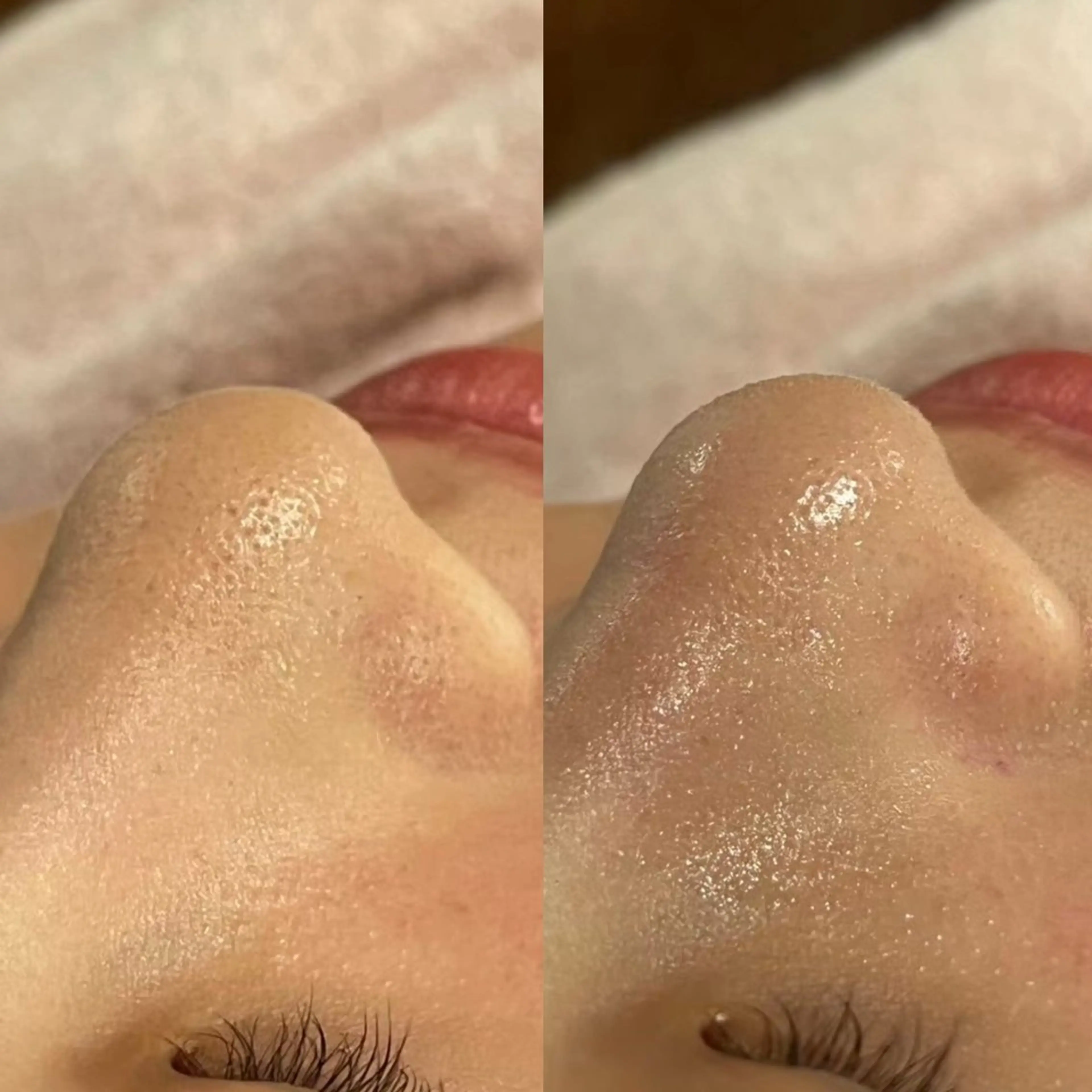 エステ LEPUS （レプス）sasaのエステ・リラクイメージ