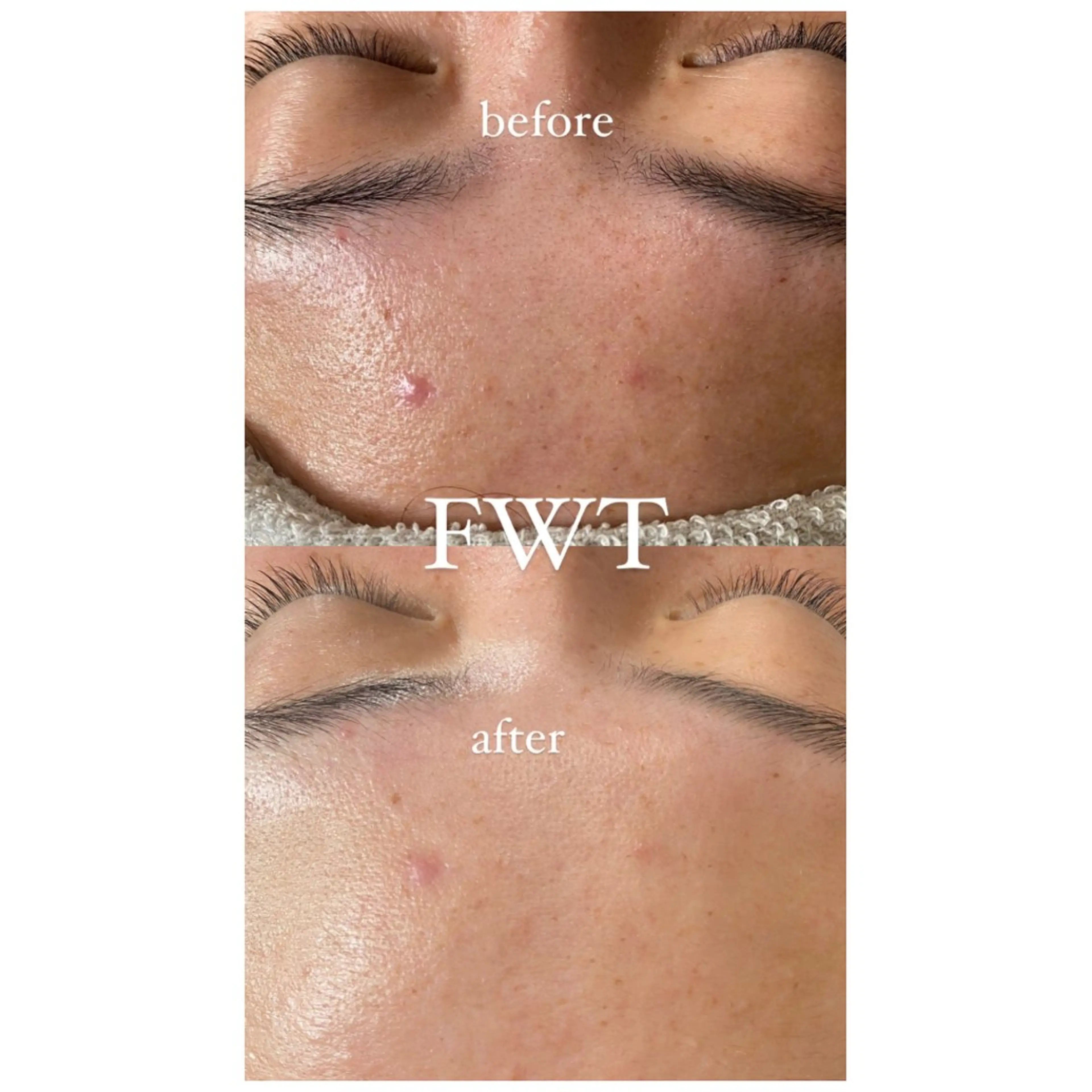 エステ デコパーツが得意♪ ネイル/眉毛/エステの眉毛・アイブロウイメージ