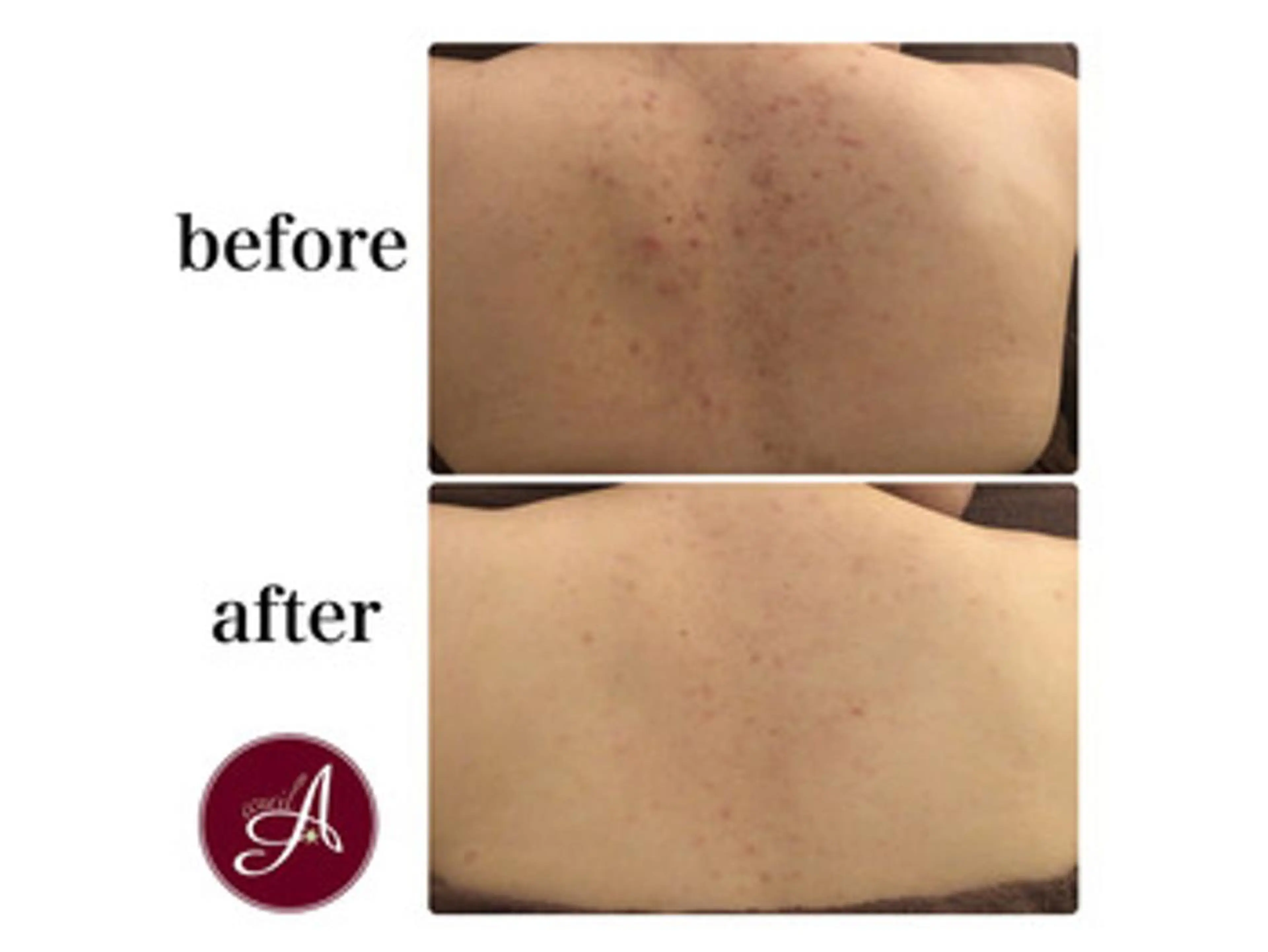 ミディアム カラー パーマ ヘアアレンジ メンズ キッズ ネイル マツエク・マツパ エステ リラク ニキビ・肌質改善専門 ♡人生が変わるサロンのエステ・リラクイメージ