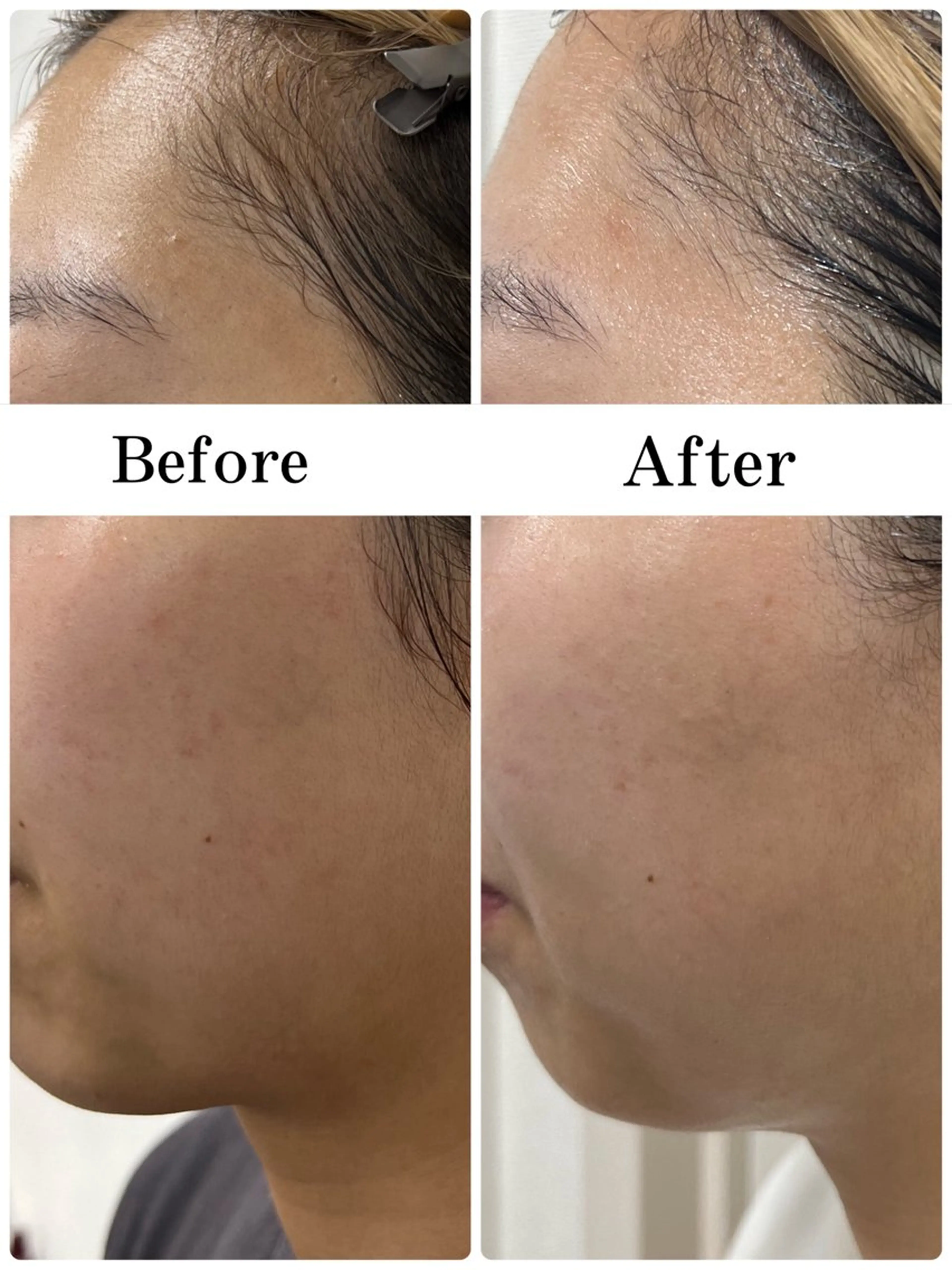 エステ デアイム 阿倍野所属・山田 萌絵のエステ・リラクイメージ