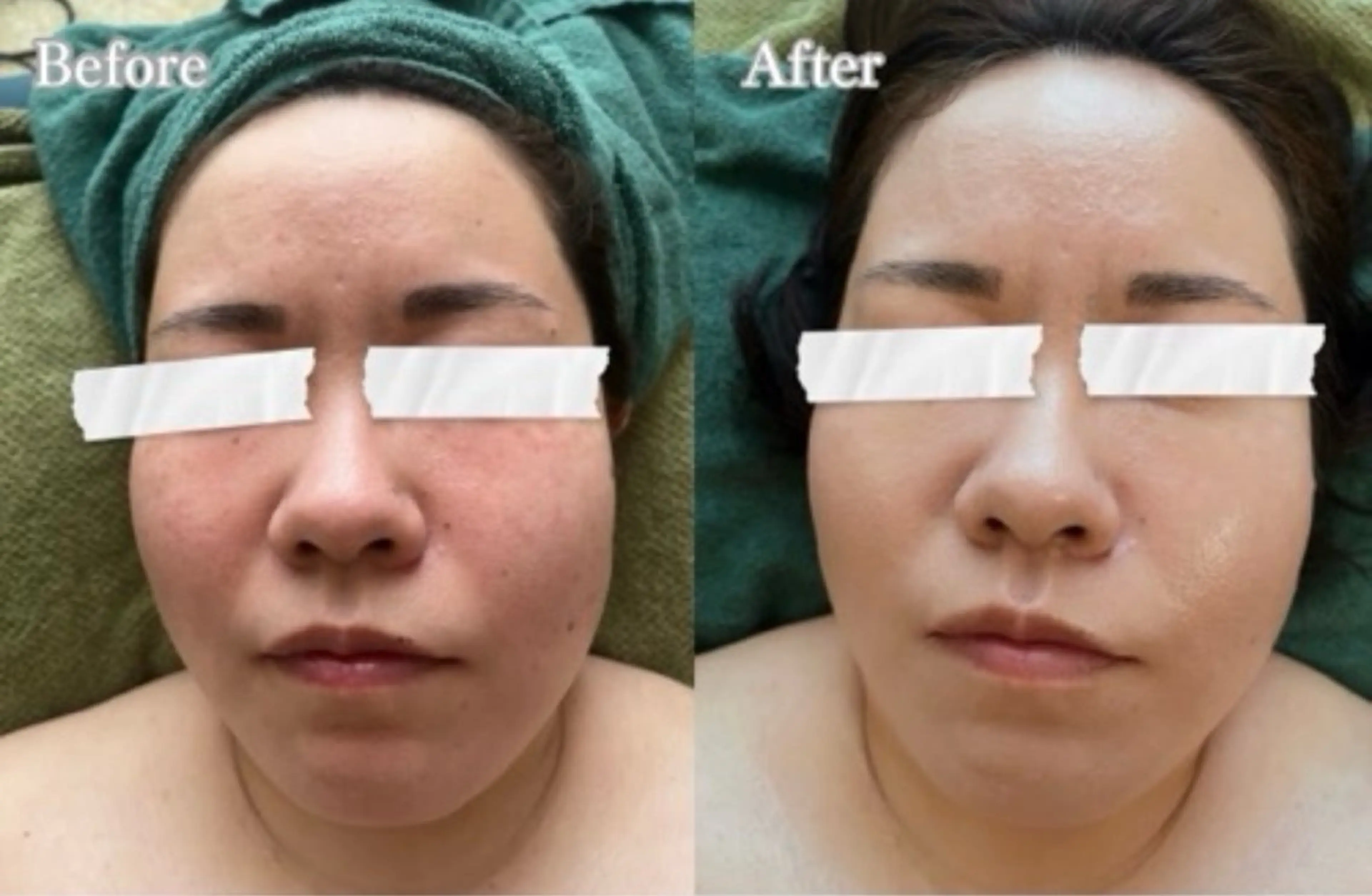 【Salon D】 HALUのエステ・リラクイメージ