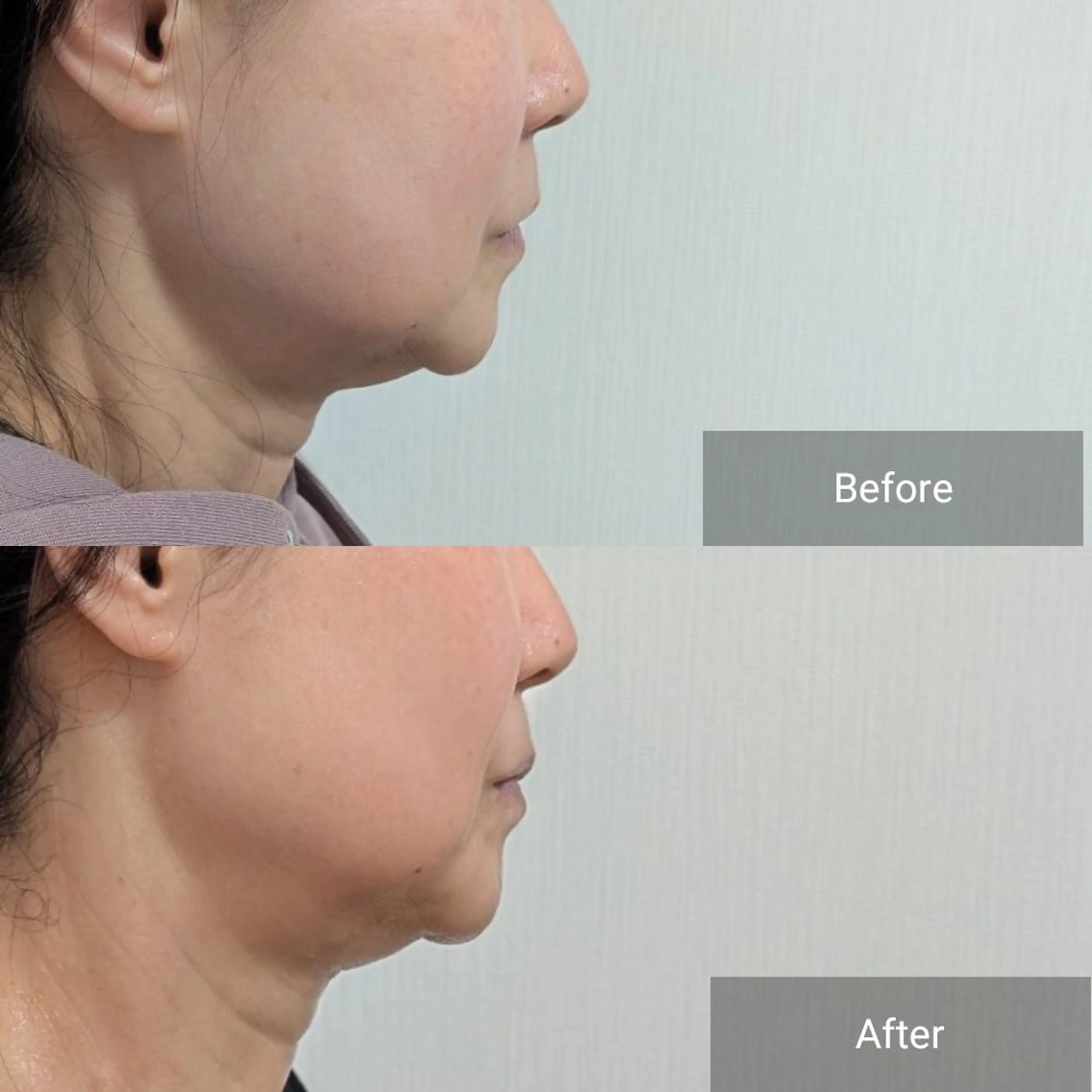 エステ nail RiRi アトレナチュラのエステ・リラクイメージ