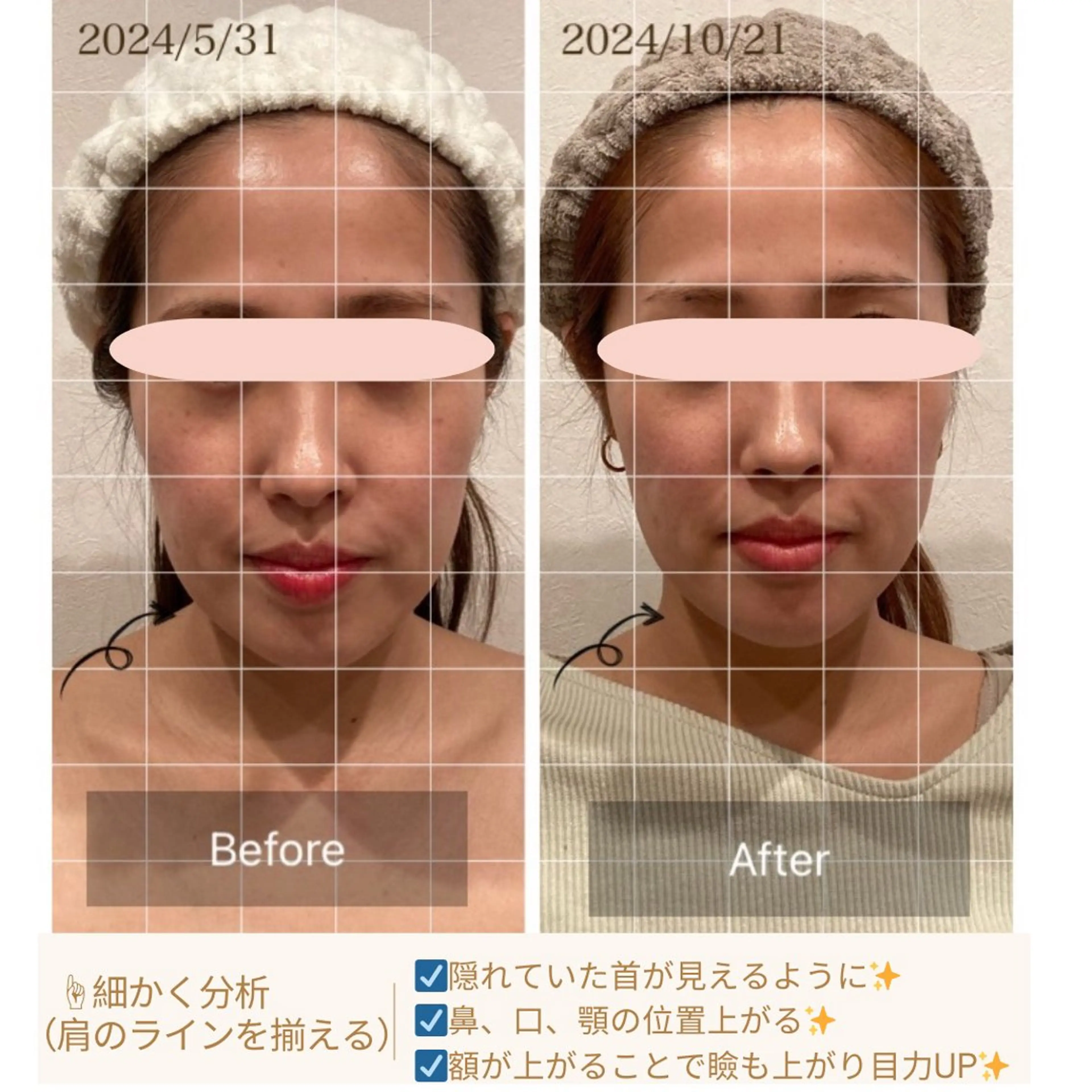 エステ リラク 小顔×肌質改善サロン soin〔ソワン〕のエステ・リラクイメージ