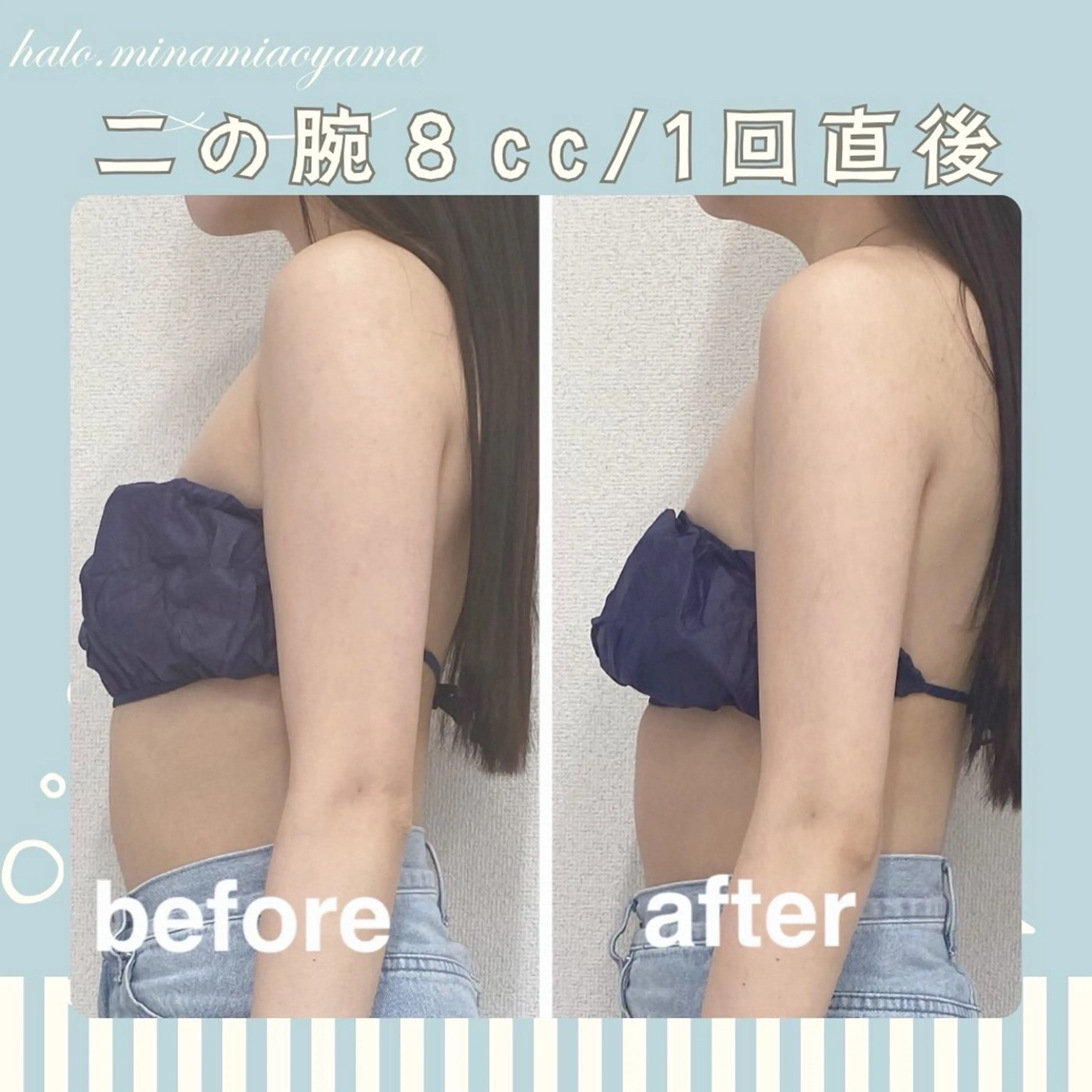 【９０分】🍋お顔+ボディOK☆レモン８ccボトル🍋1​〜​2部位の写真