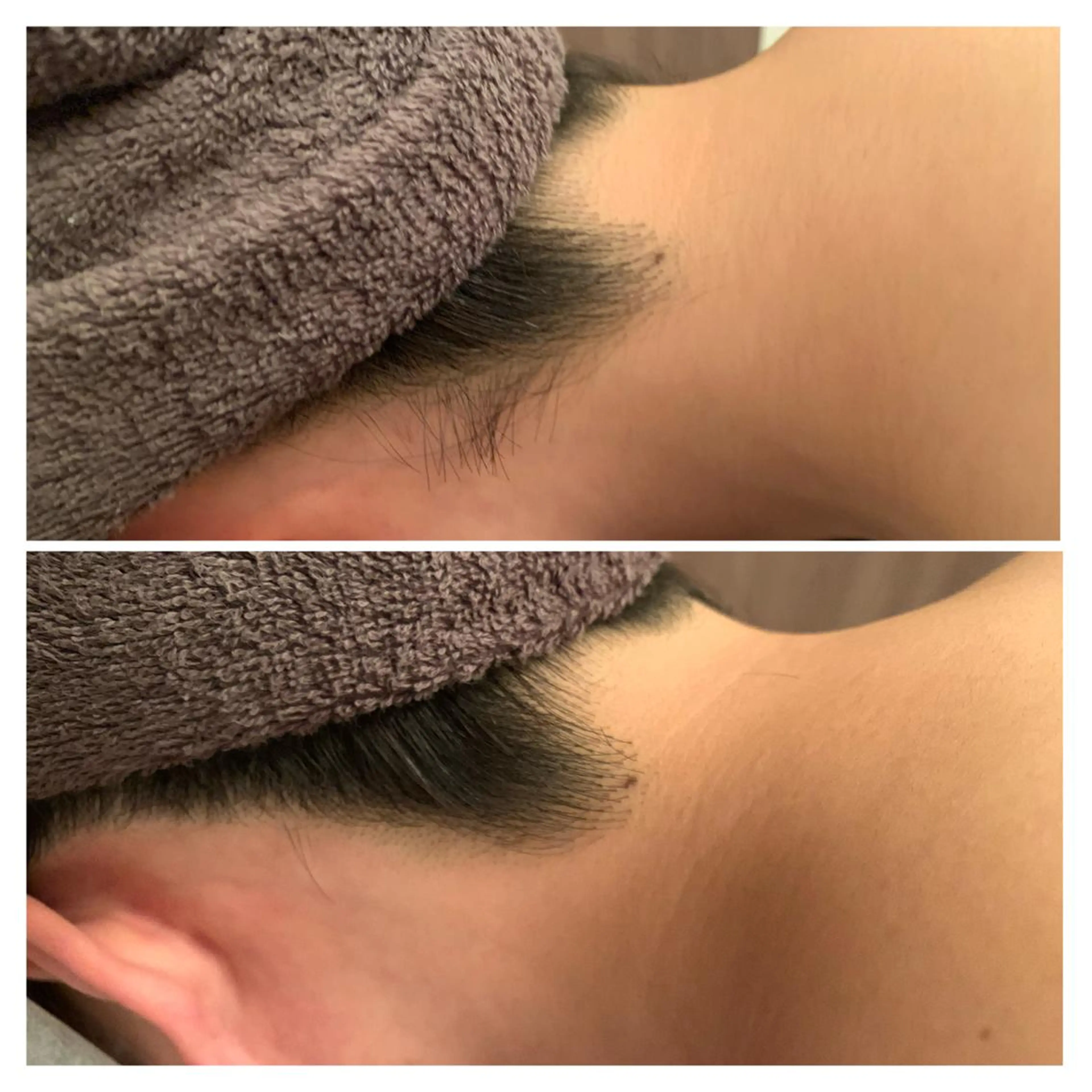 食べながら魅せボディ éclatJua川越のエステ・リラクイメージ