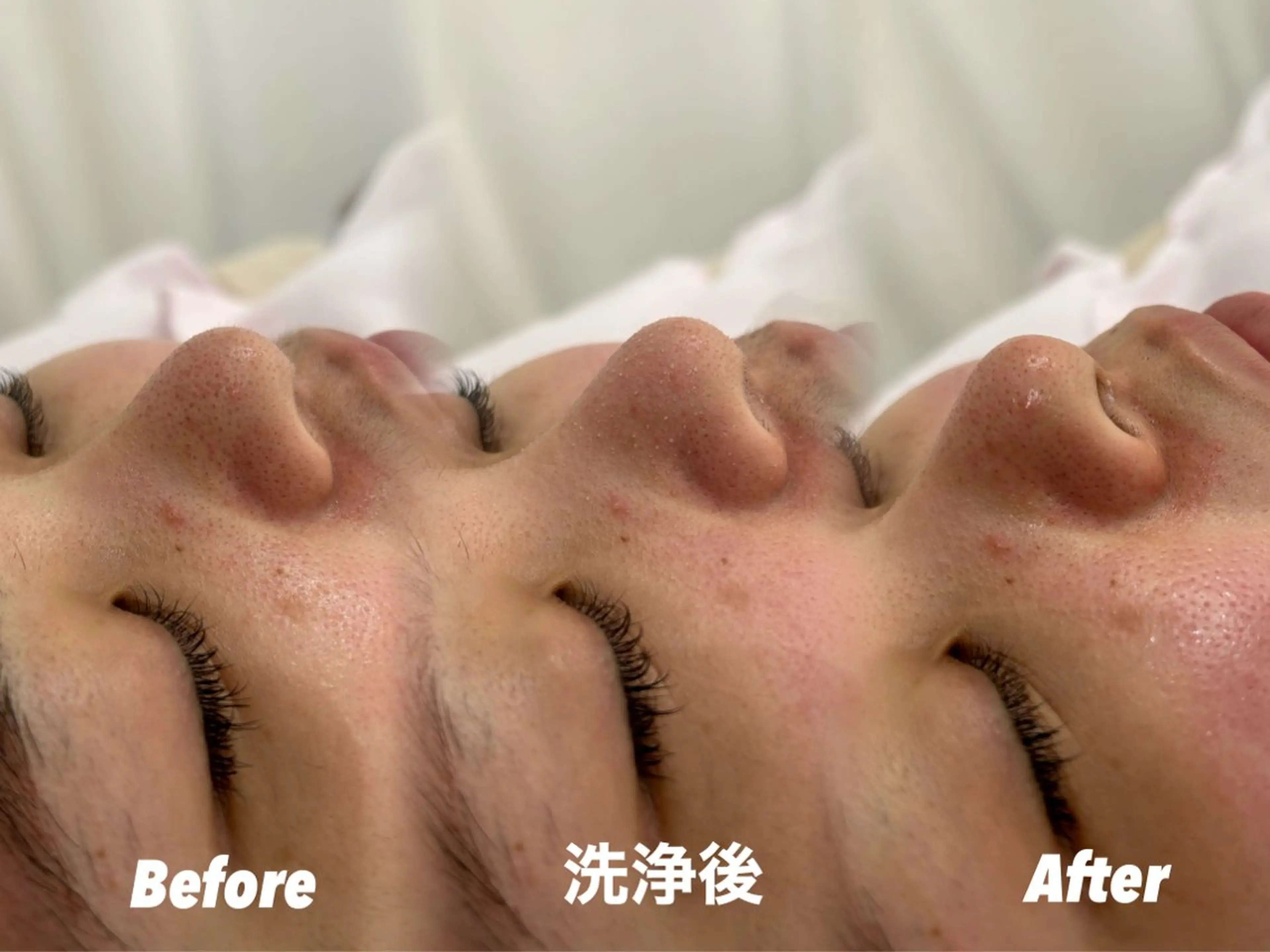 その他 🫧美しい素肌へ🫧 今成柚乃のその他イメージ