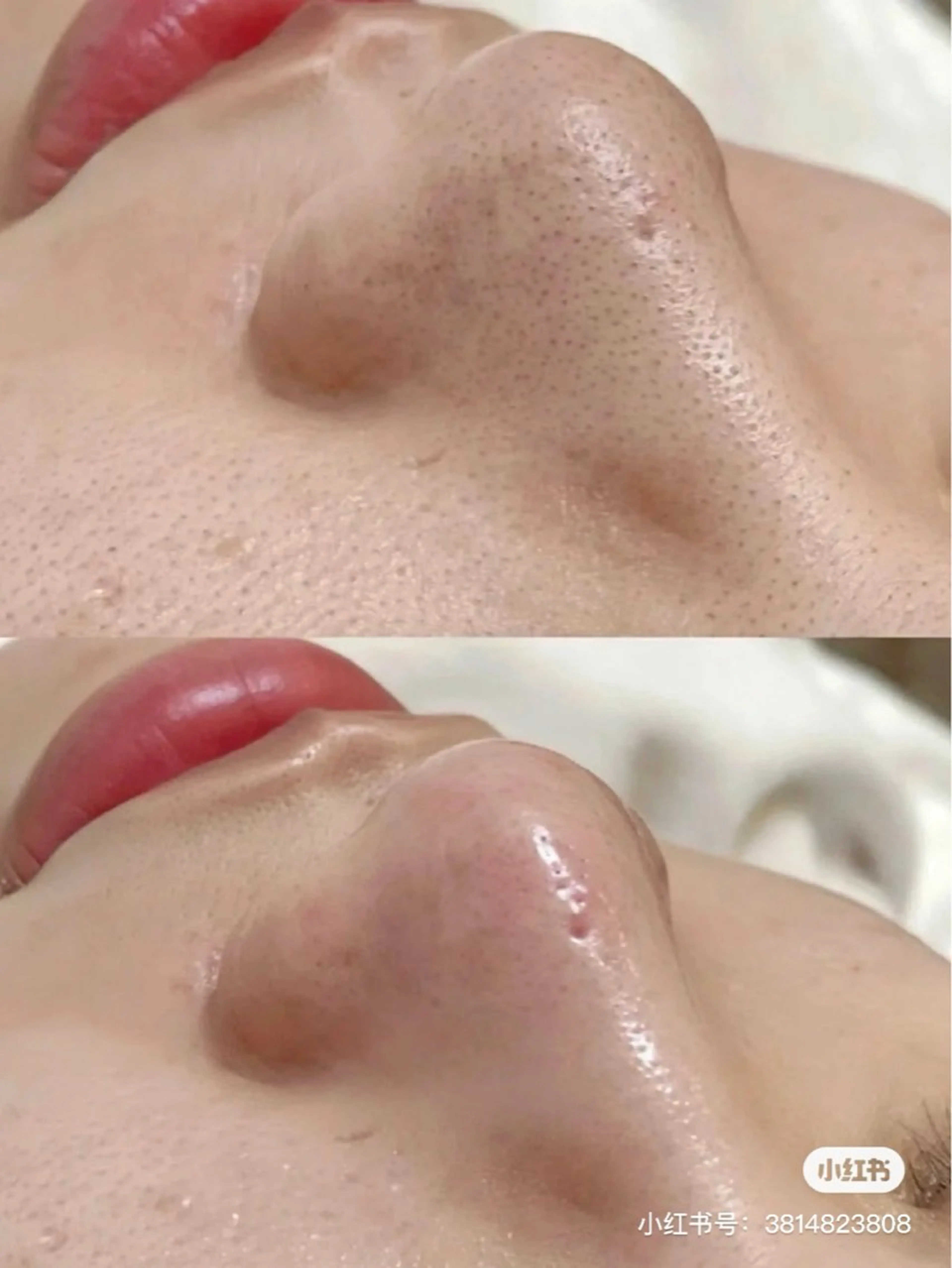 マツエク・マツパ エステ aliaハイフ&水光ジェットサロン所属・aliaハーブ水光店 エステティシャン募集のエステ・リラクイメージ