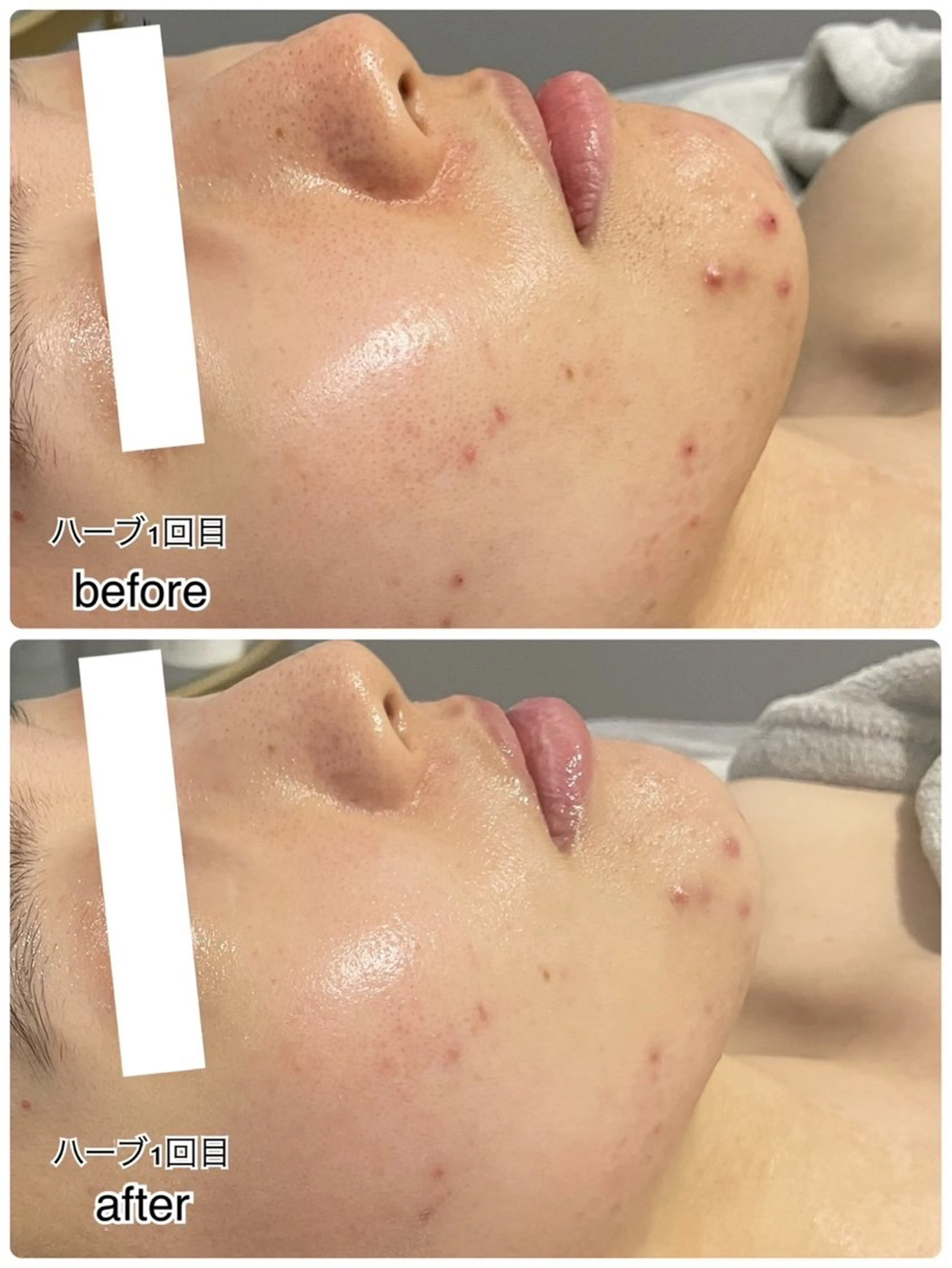 ENCHANT Kaede/肌質改善のその他イメージ