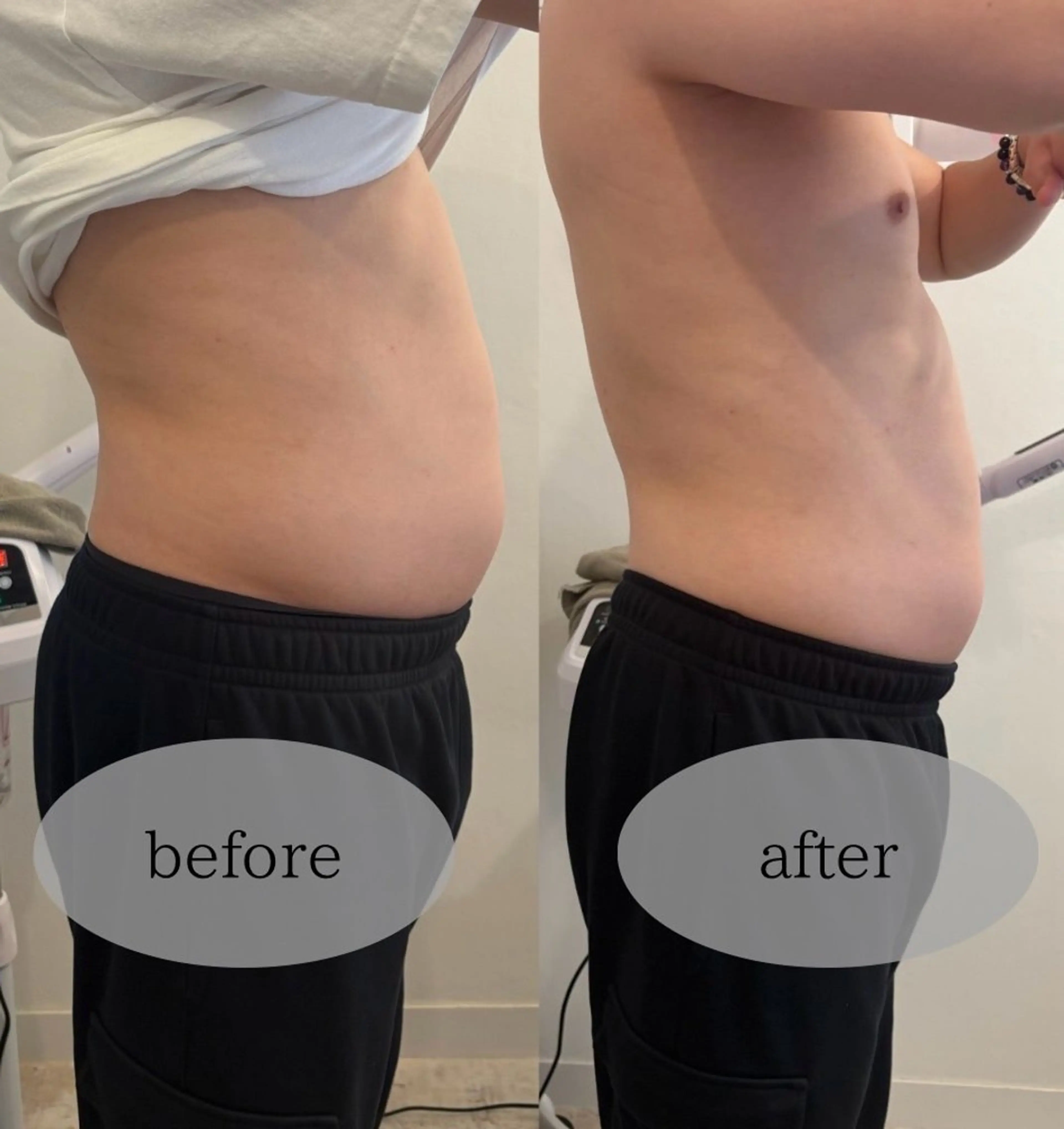 エステ リラク 腸活サポート みなみののエステ・リラクイメージ