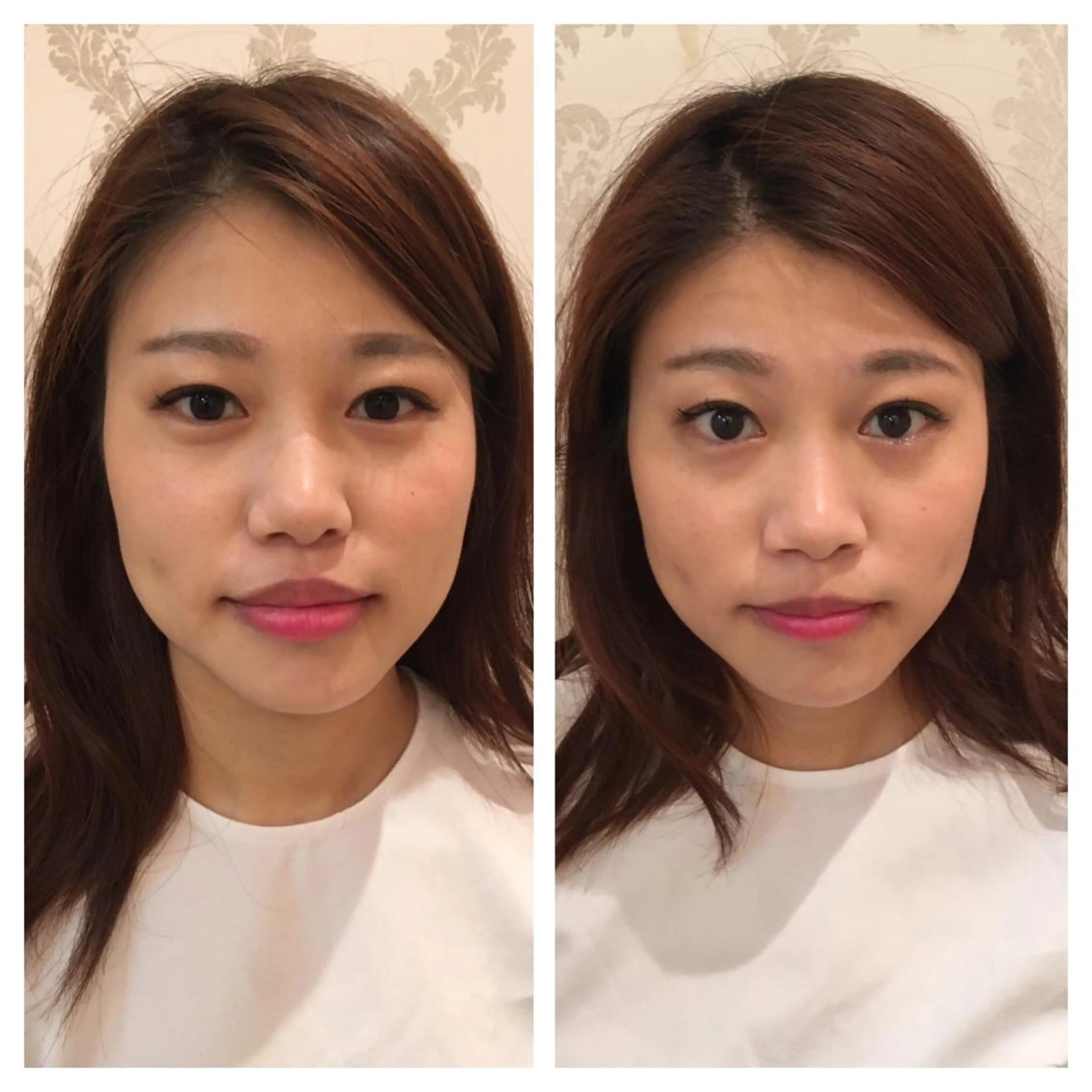 美容鍼サロン    Fleurir所属・伊藤 かなえのエステ・リラクイメージ