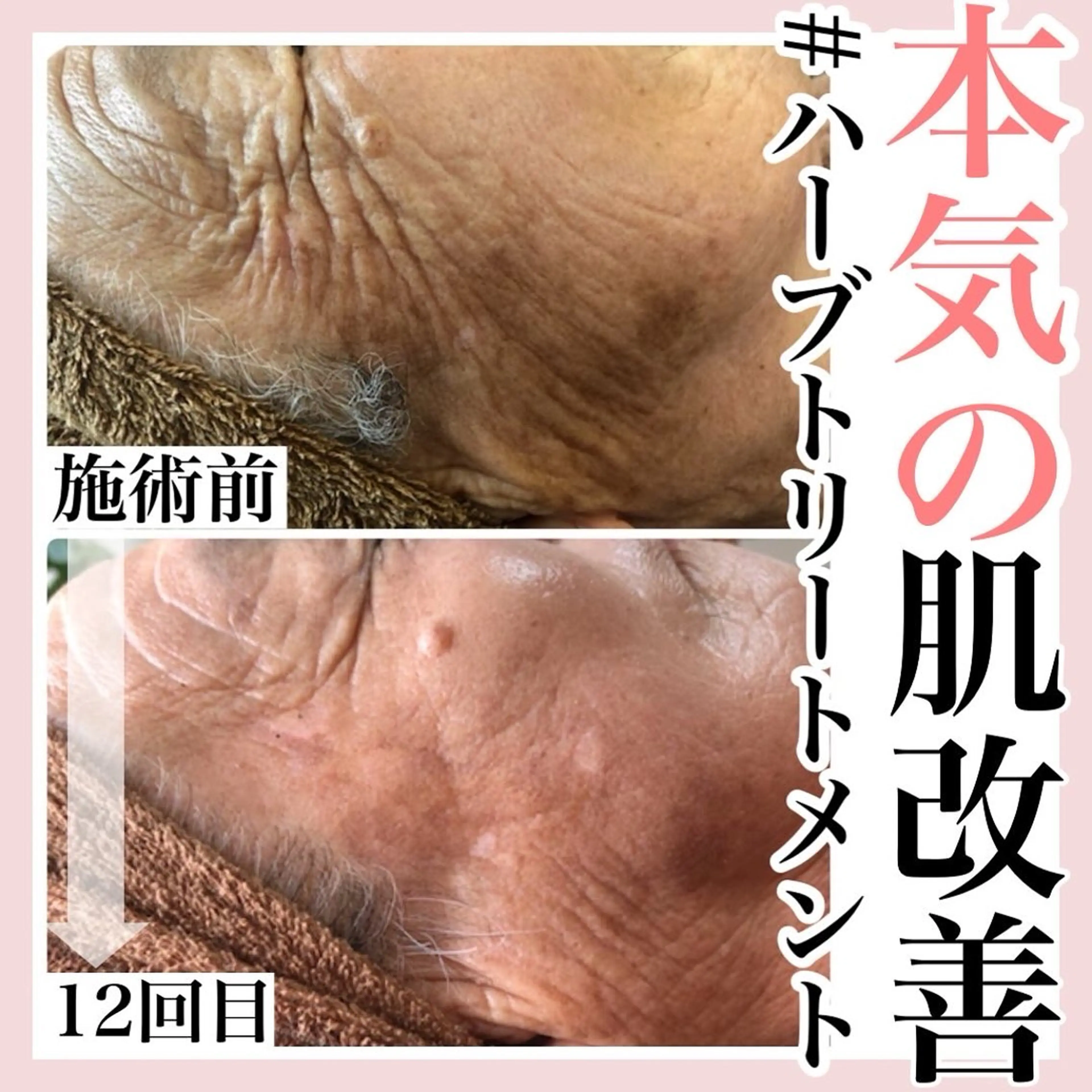 アイブロウ エステ 毛穴専門店hula 杉山智美のエステ・リラクイメージ