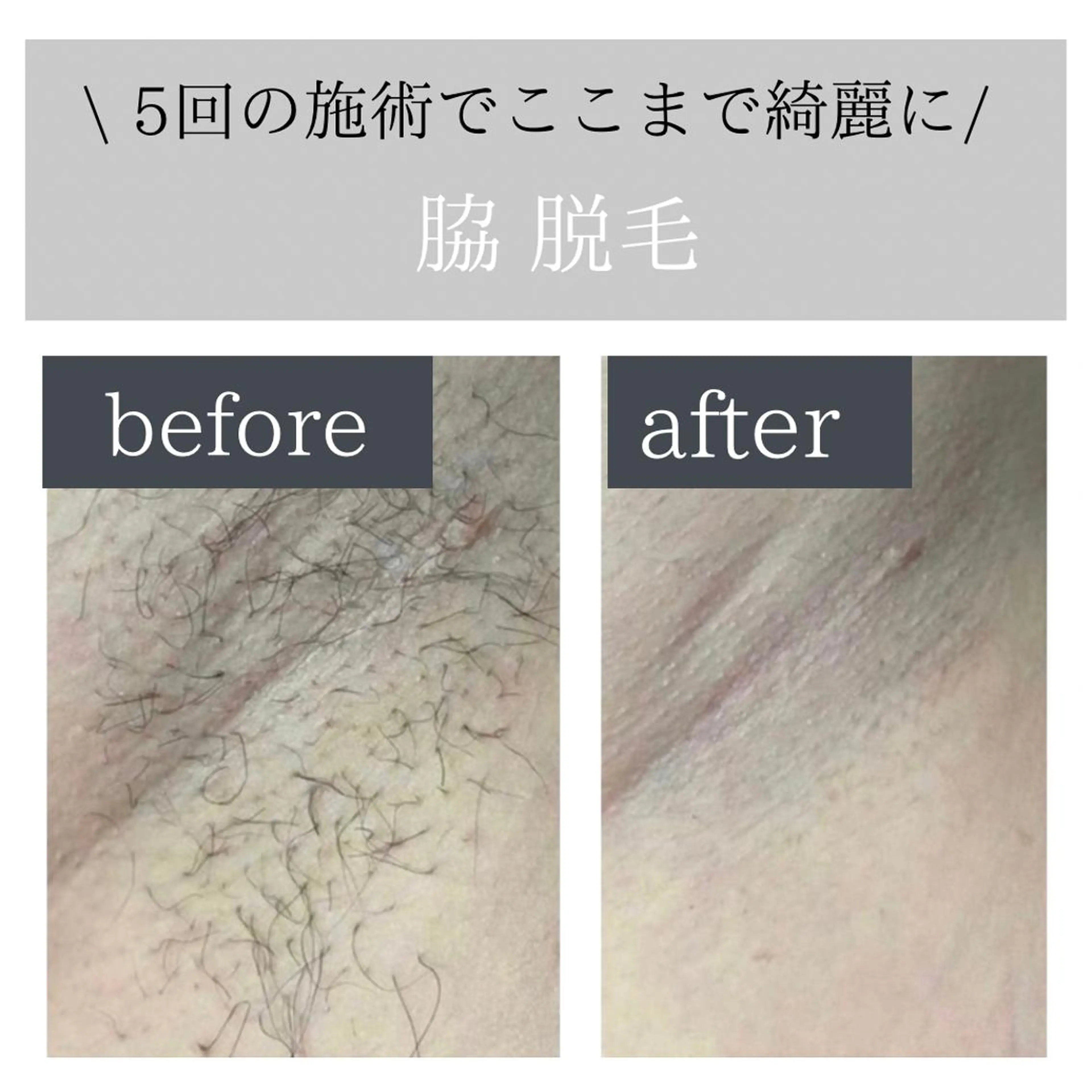 Lokahi所属・脱毛サロン Lokahiのエステ・リラクイメージ