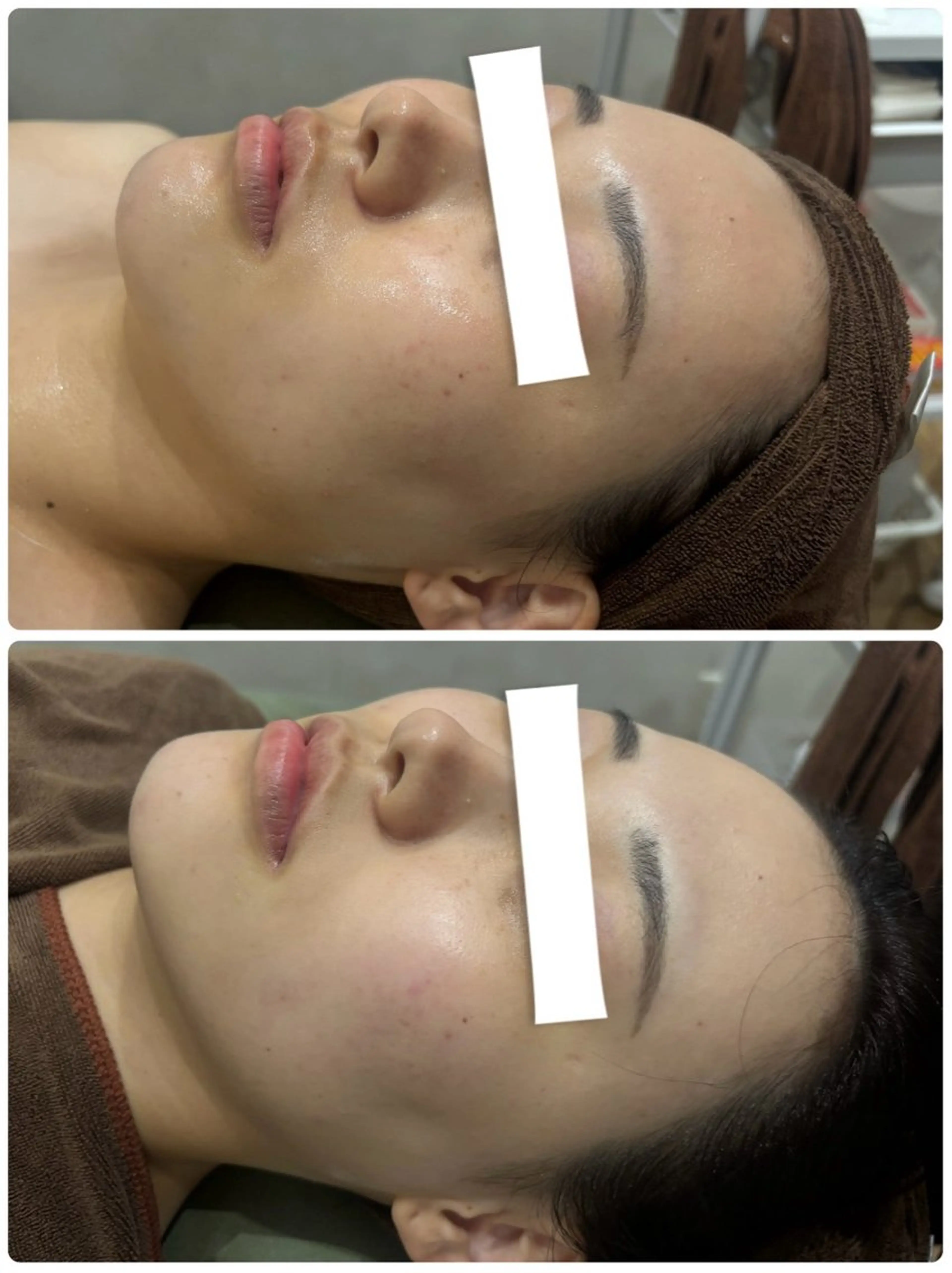 大人気❣️小顔フェイシャル❣️‪ 【お顔マッサージ付き✨️】‼️11月末まで‼️の写真