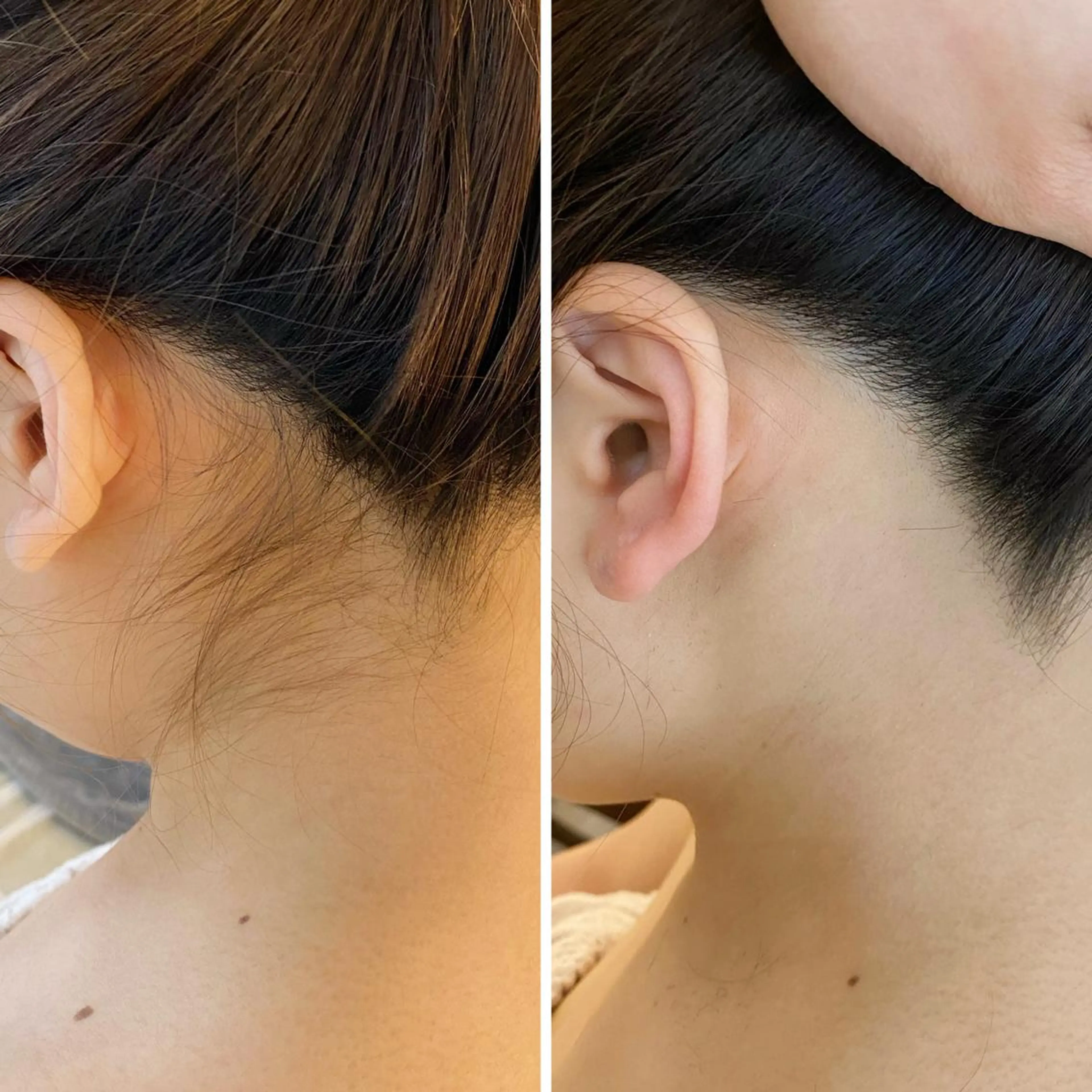 うなじ脱毛/美肌脱毛 LABELのエステ・リラクイメージ