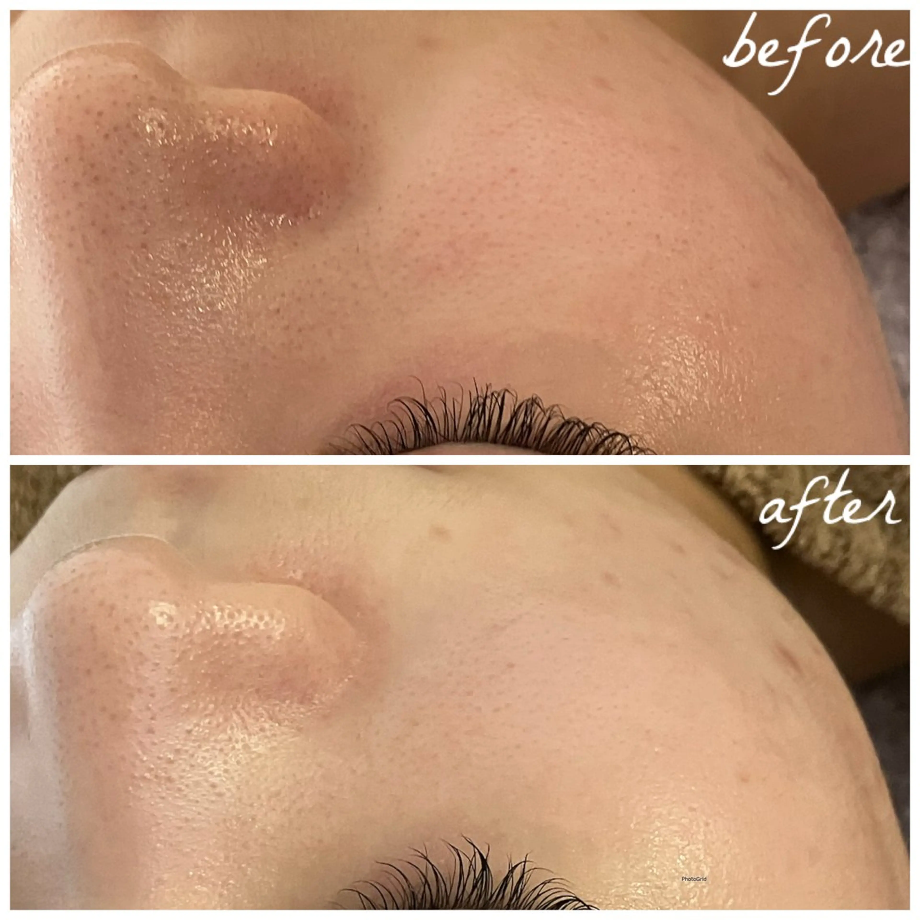 メンズ エステ メナード岐阜茜部 杉浦のエステ・リラクイメージ