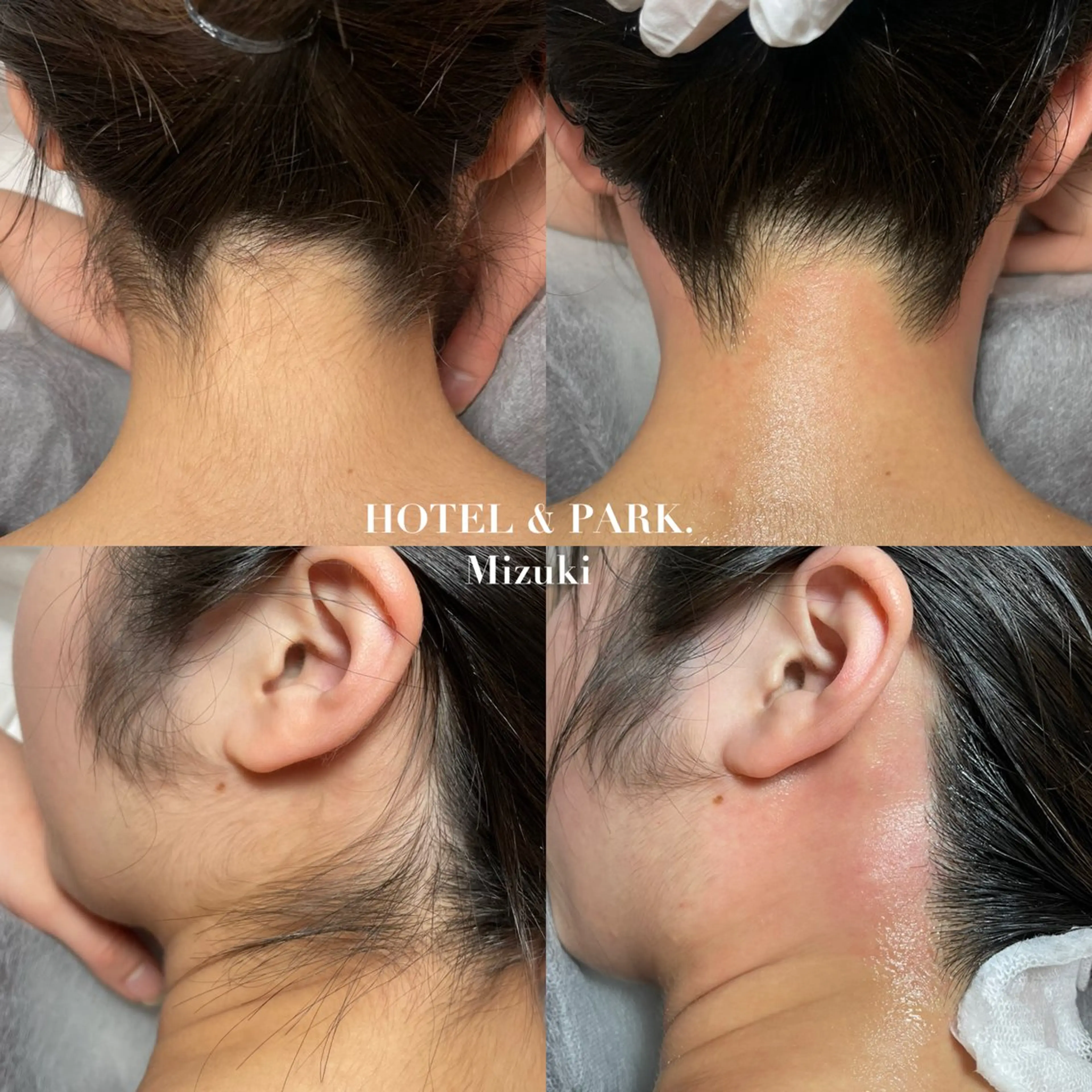 脱毛 HOTEL&PARK . ワックス脱毛のエステ・リラクイメージ