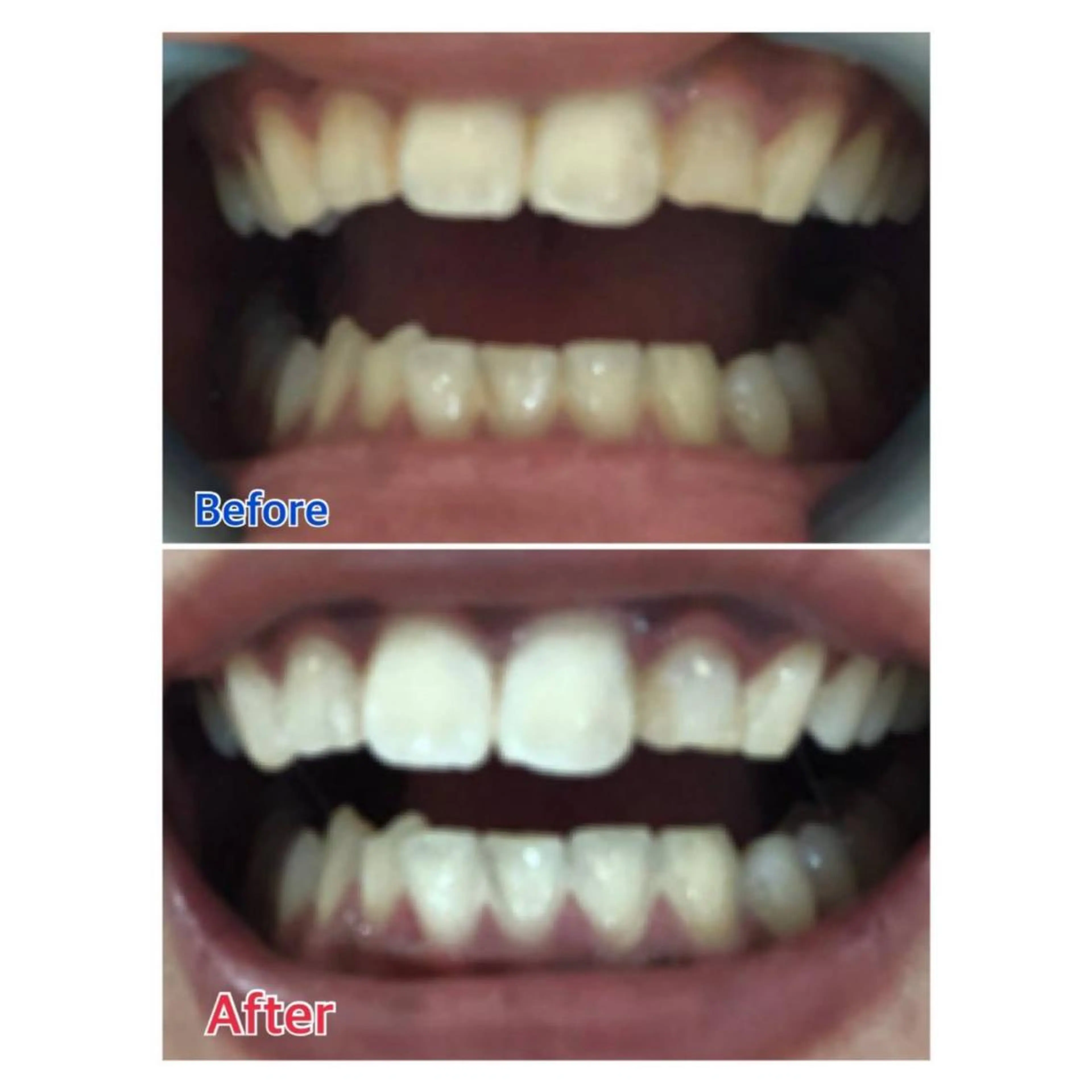 MBEAUTYSALON 千葉店・京成大久保所属・Melty 輝のその他イメージ