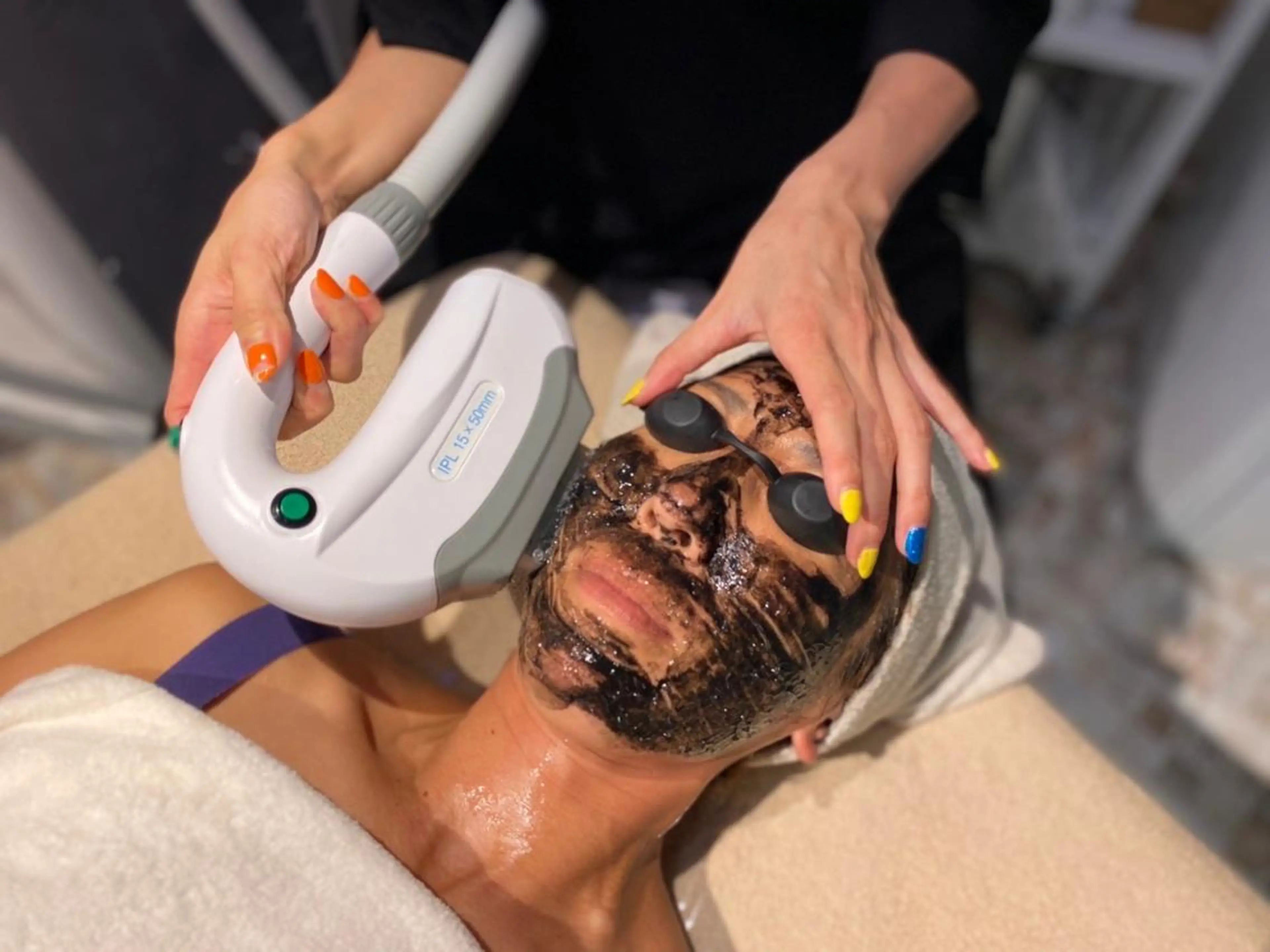 ☆毛穴、角質スッキリ☆ブラックフェイシャルの写真