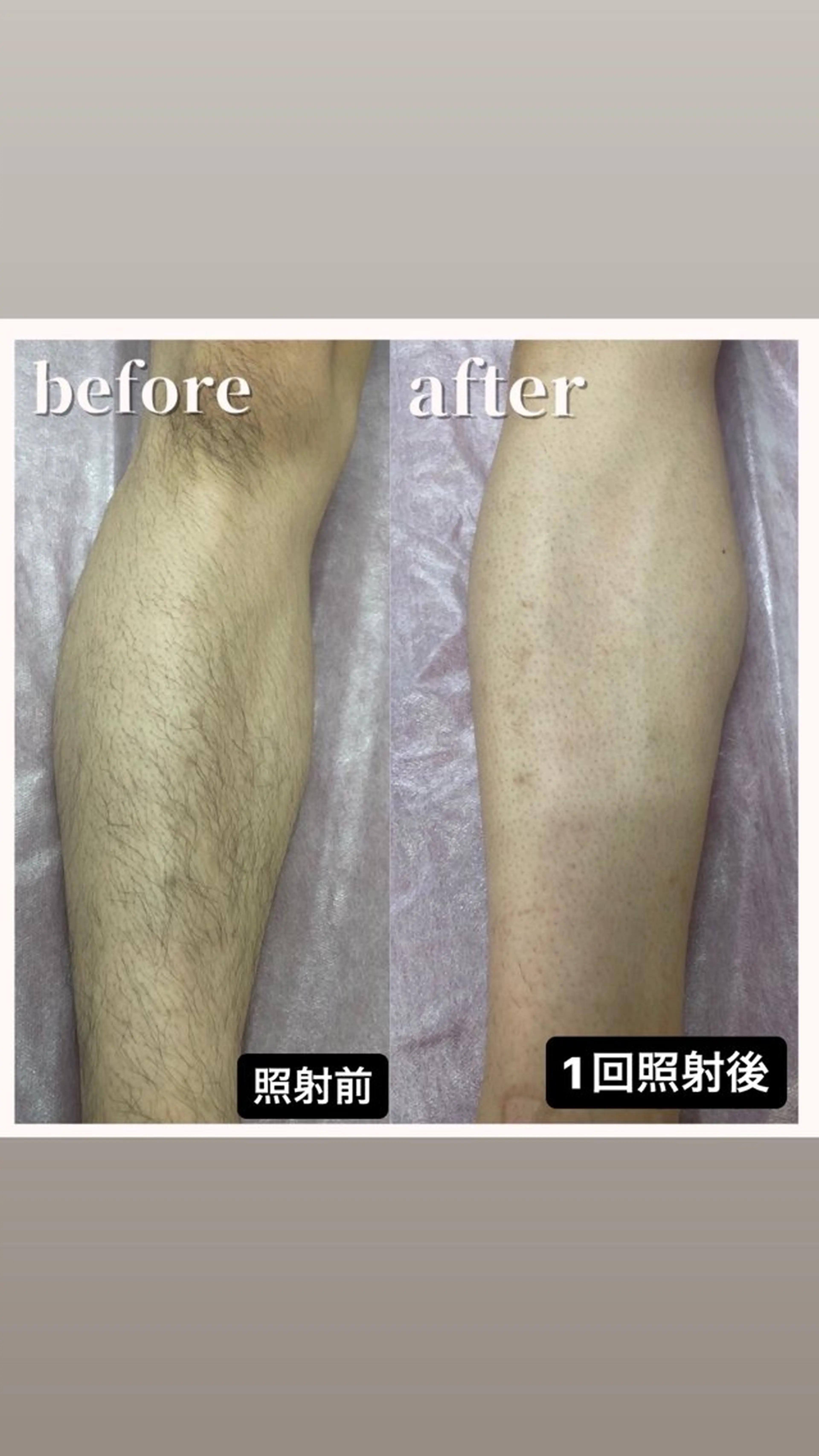 メンズ メンズ脱毛サロン kurozukinのエステ・リラクイメージ