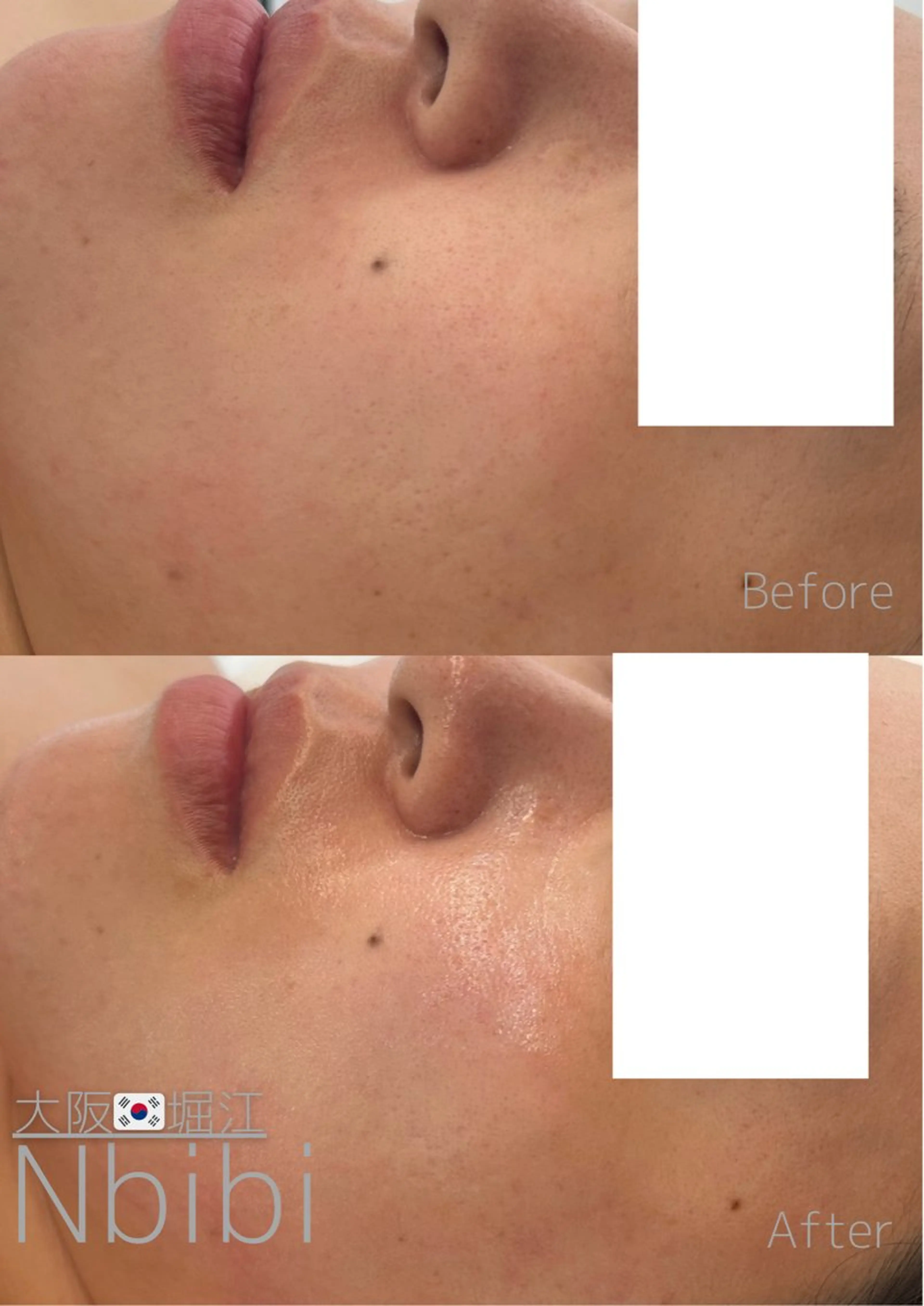 エステ 韓国🇰🇷価格 サロン_Nbibiのエステ・リラクイメージ