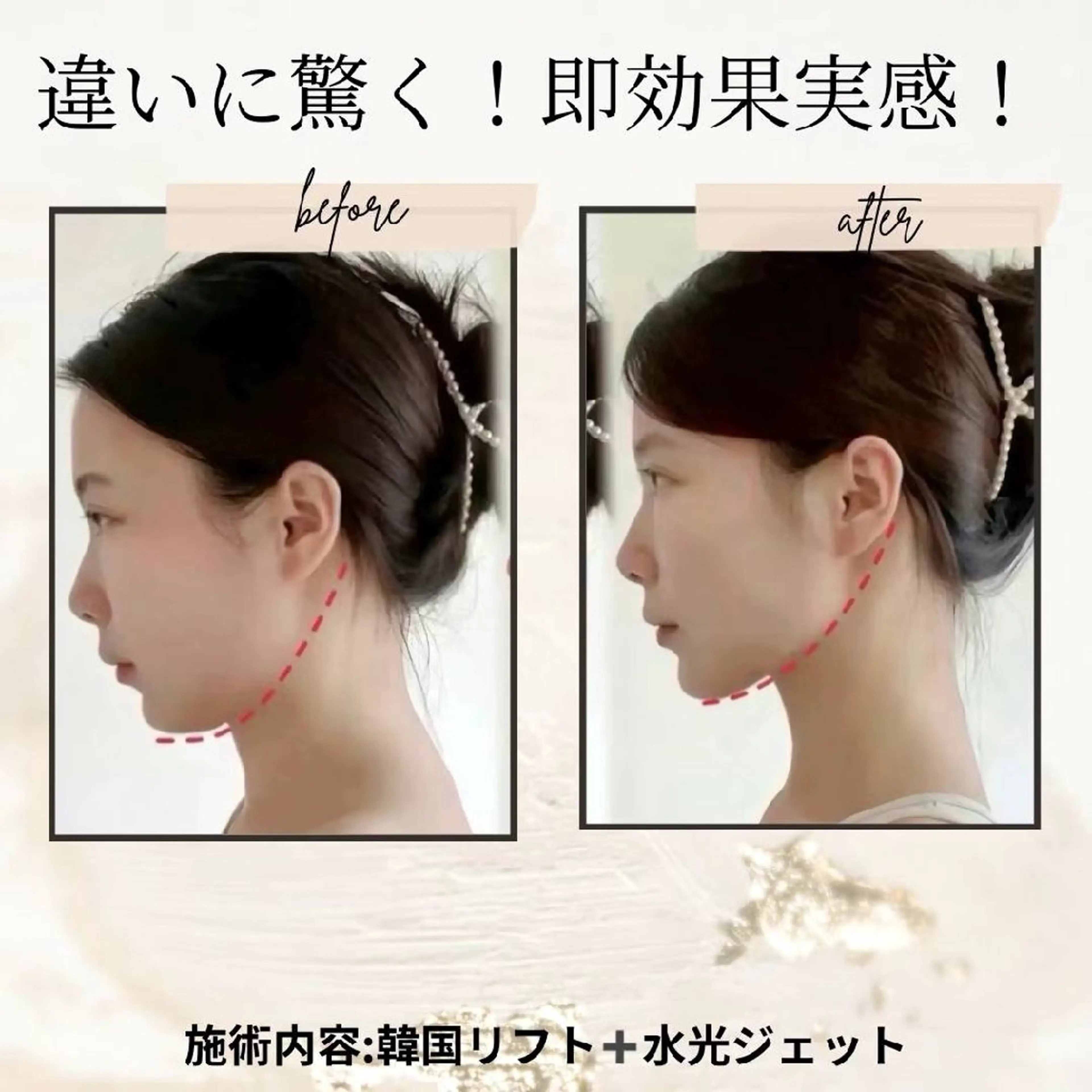 ネイル ブライダルネイル ホワイト aliaハイフ&水光ジェットサロン所属・aliaハーブ水光店 エステティシャン募集のエステ・リラクイメージ