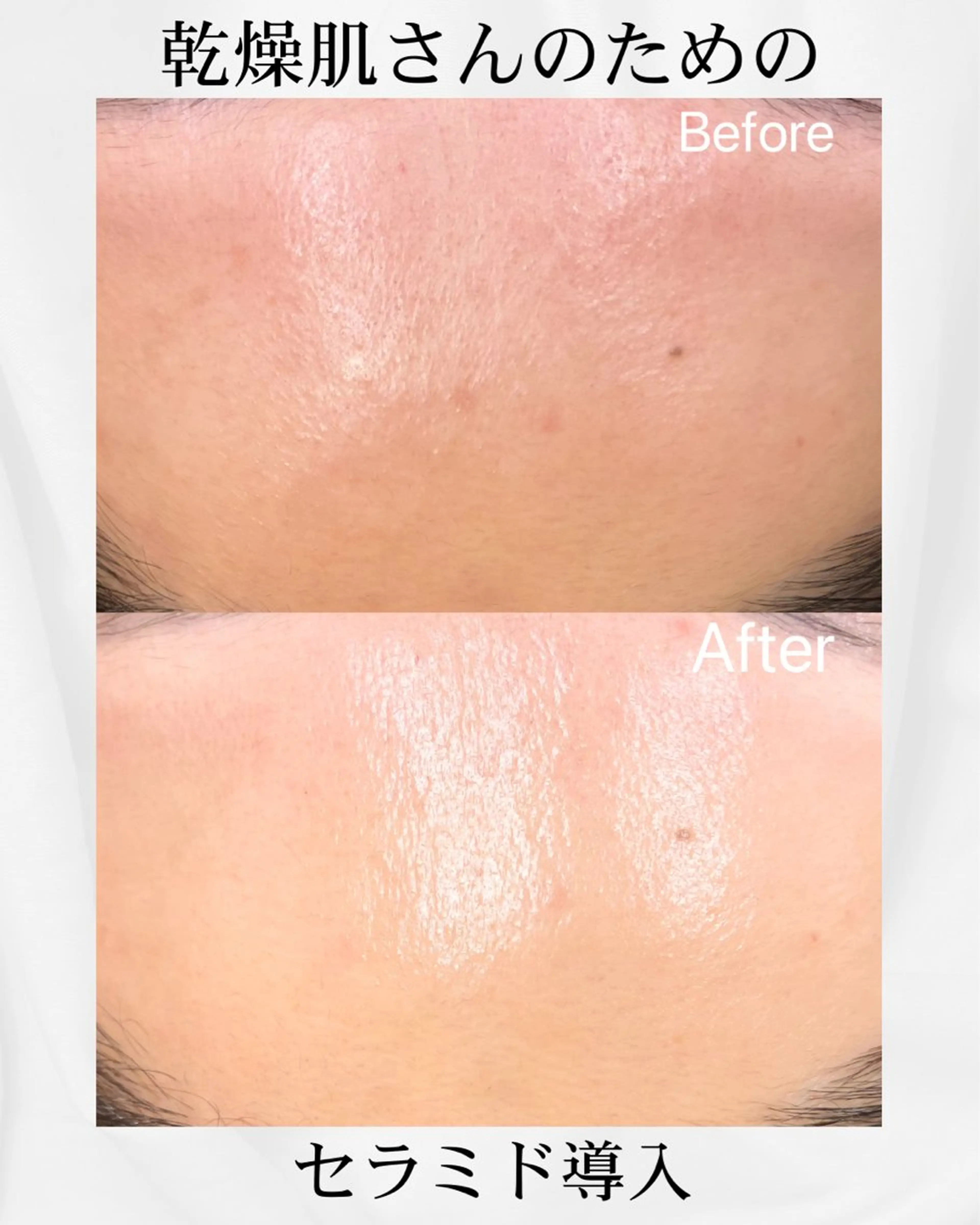 エステ アイラッシュ&エステサロンLinda西宮所属・小顔&毛穴・肌質改善 LINDA西宮 AIのエステ・リラクイメージ