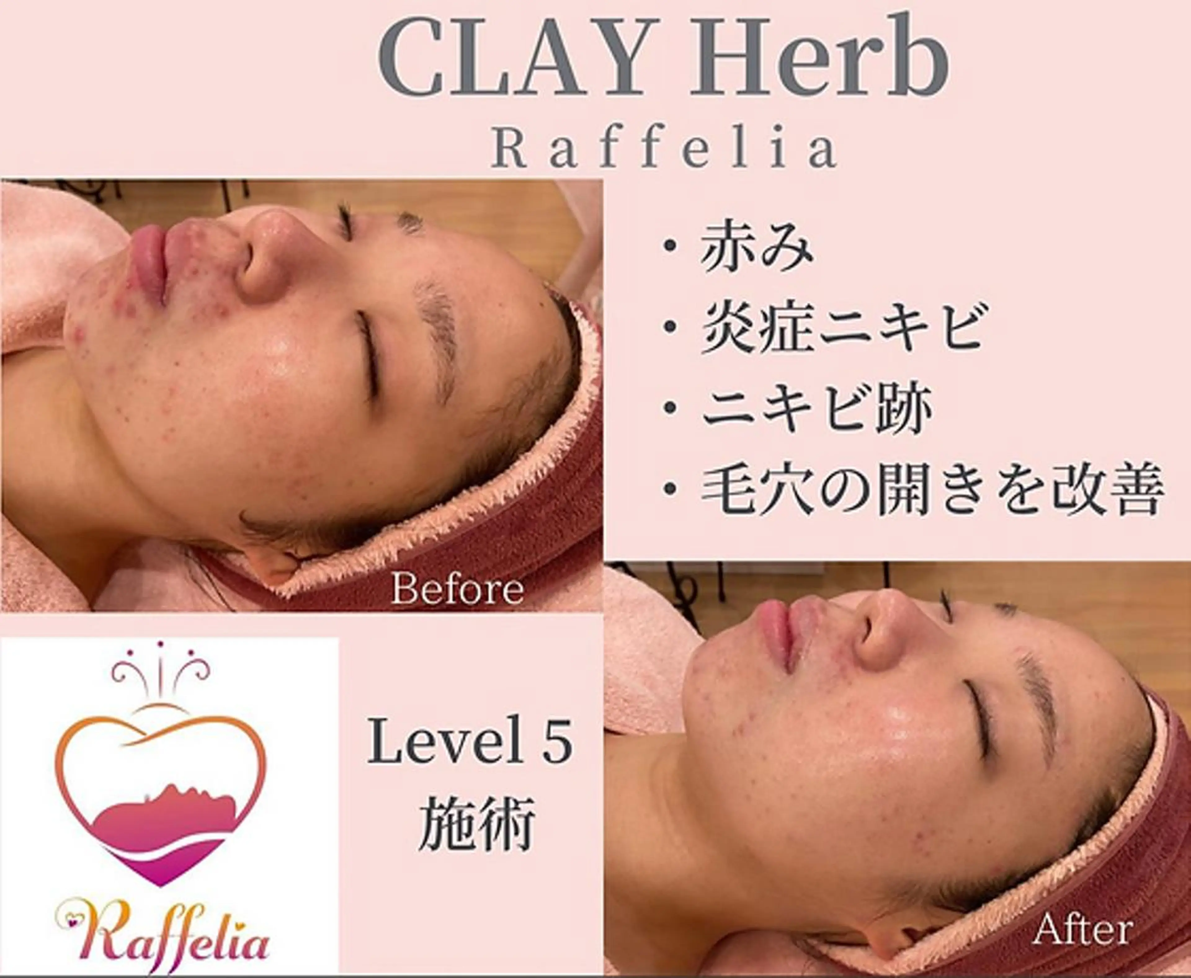 🌈Raffelia ラフェリア✨のエステ・リラクイメージ