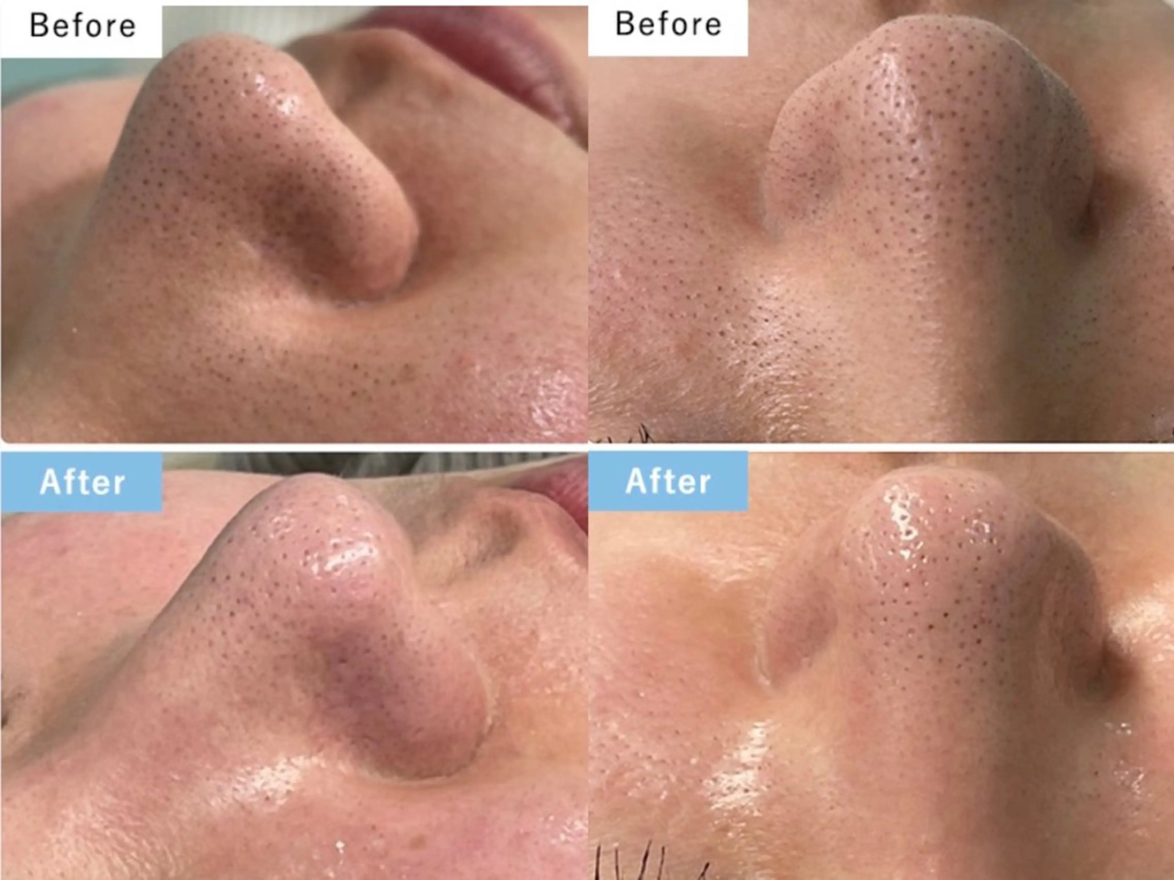 Laule'a ラウレアのエステ・リラクイメージ