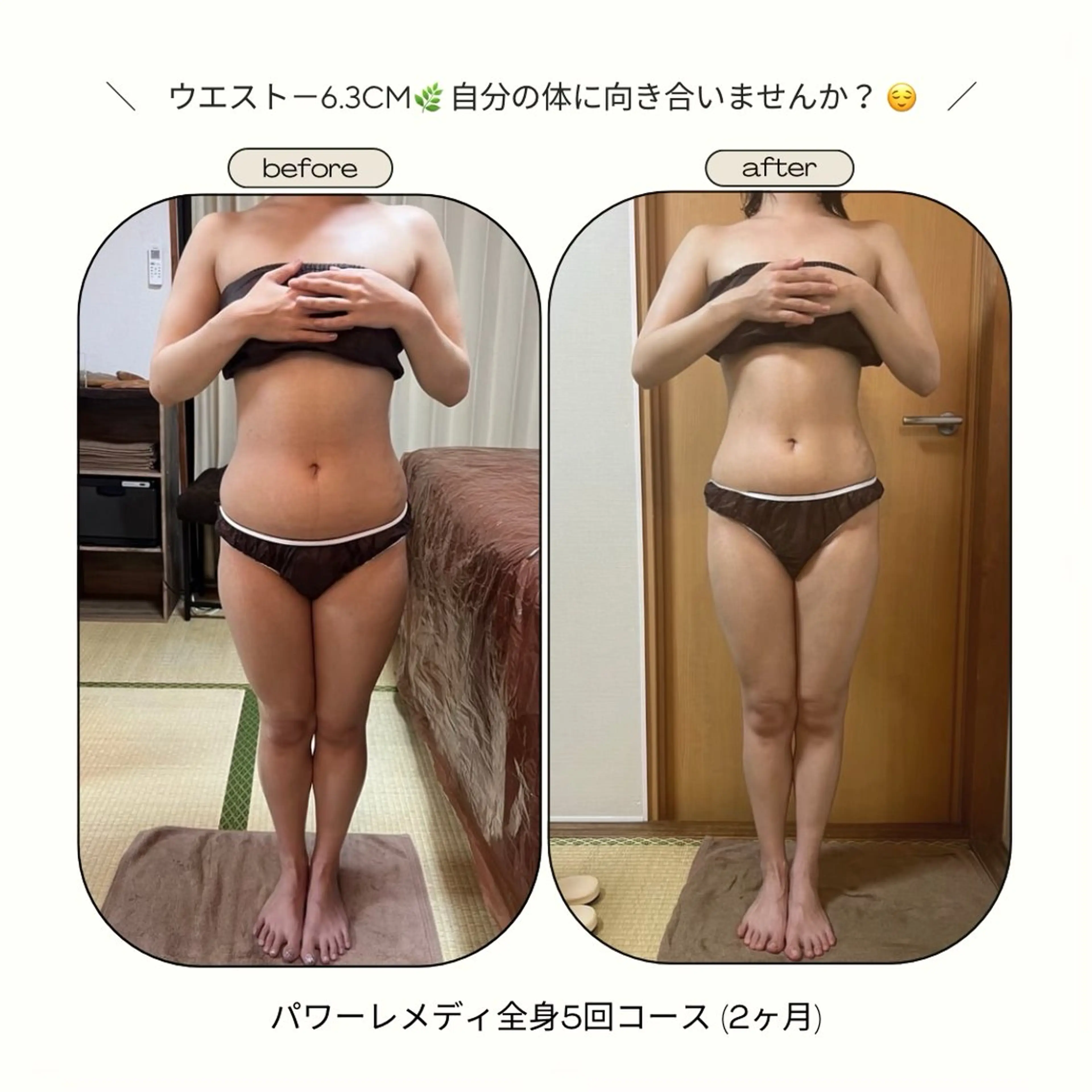 biloop所属・《本気痩せ×疲労改善 》  BILOOPのエステ・リラクイメージ