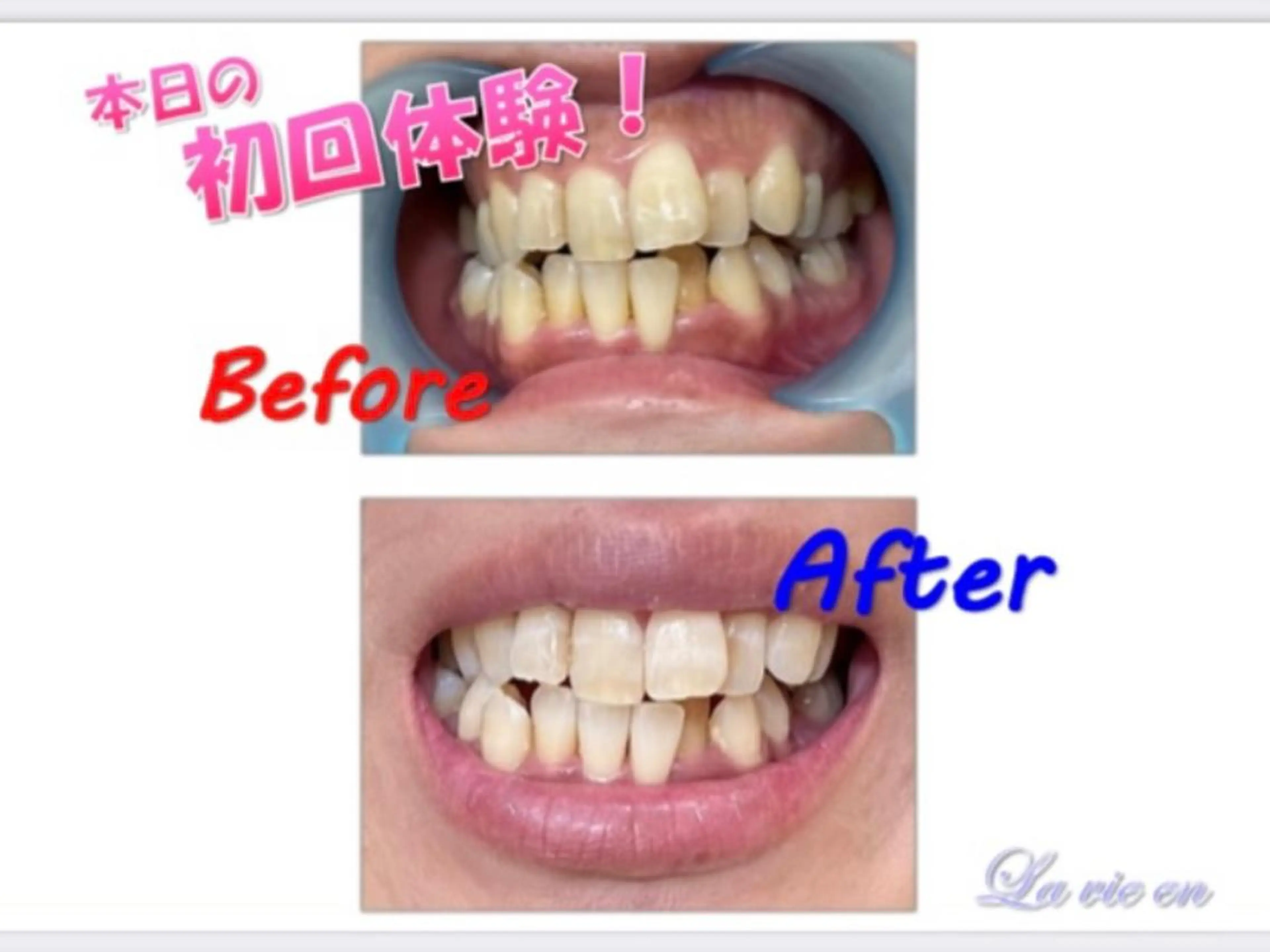 その他 セルフホワイトニングサロン　ラヴィアン所属・ホワイトニングサロン La vie enのその他イメージ
