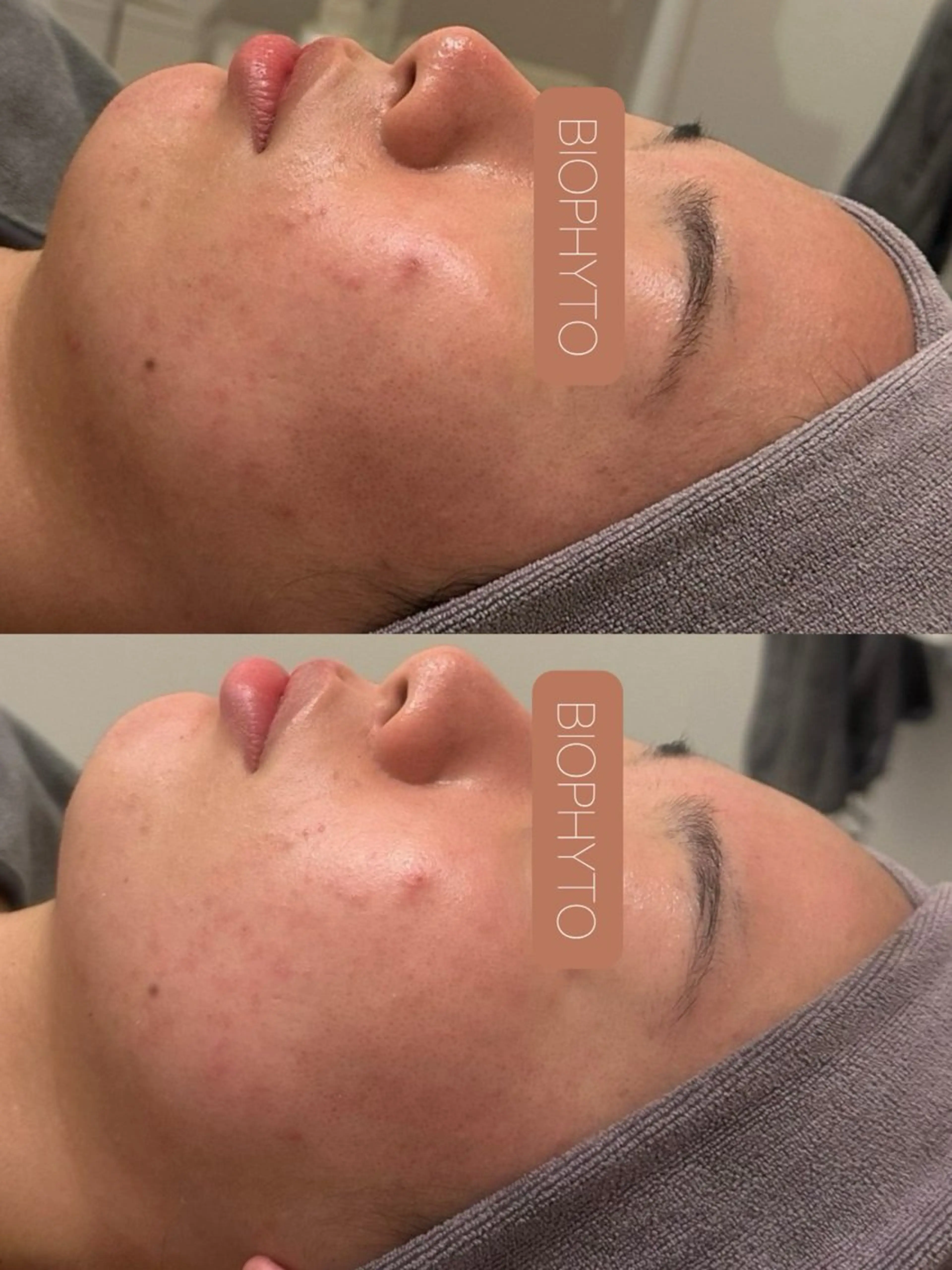 ☆痩身/小顔☆ コルギのエステ・リラクイメージ