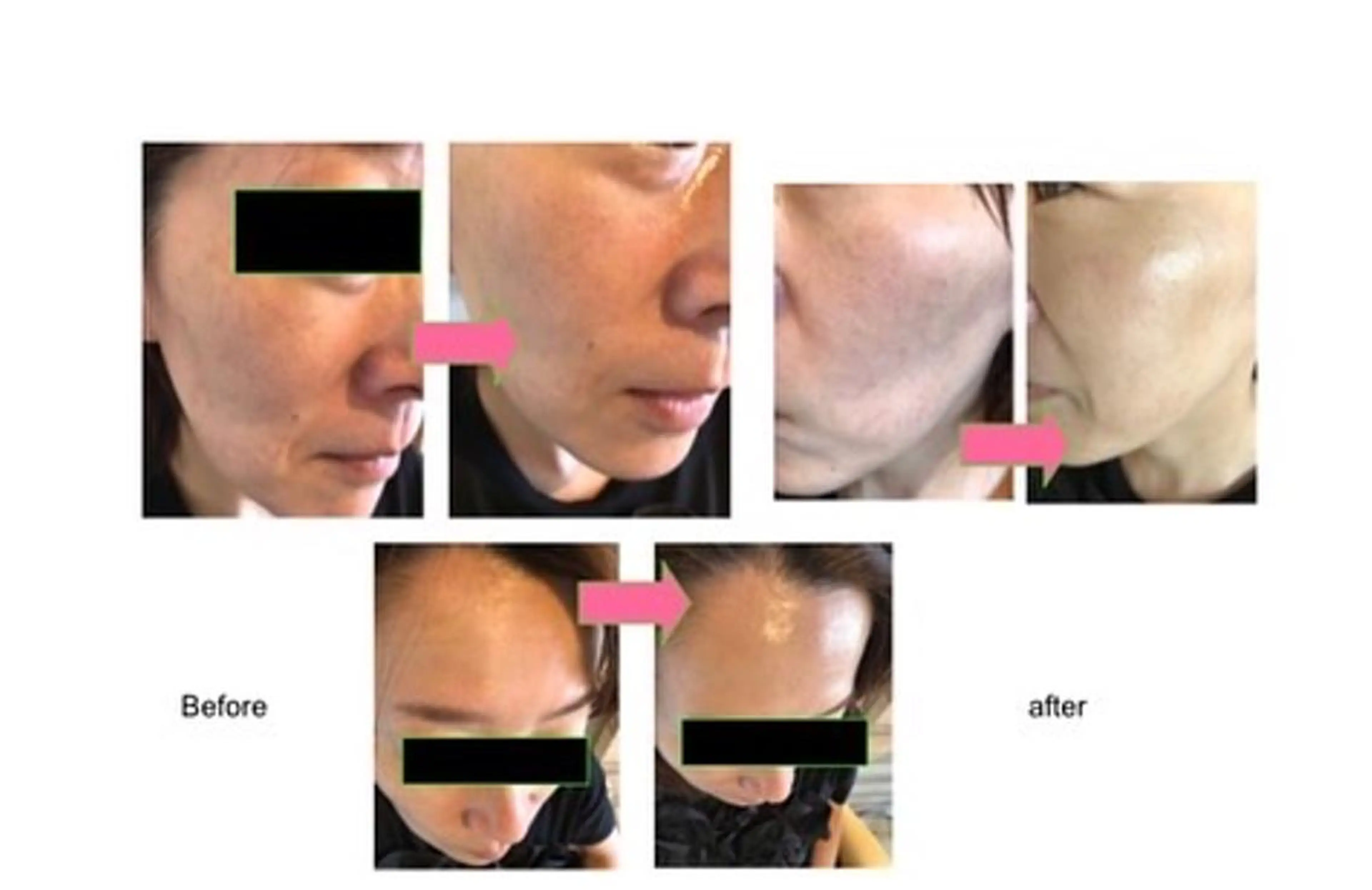 noel de mi 前川亜里沙のエステ・リラクイメージ