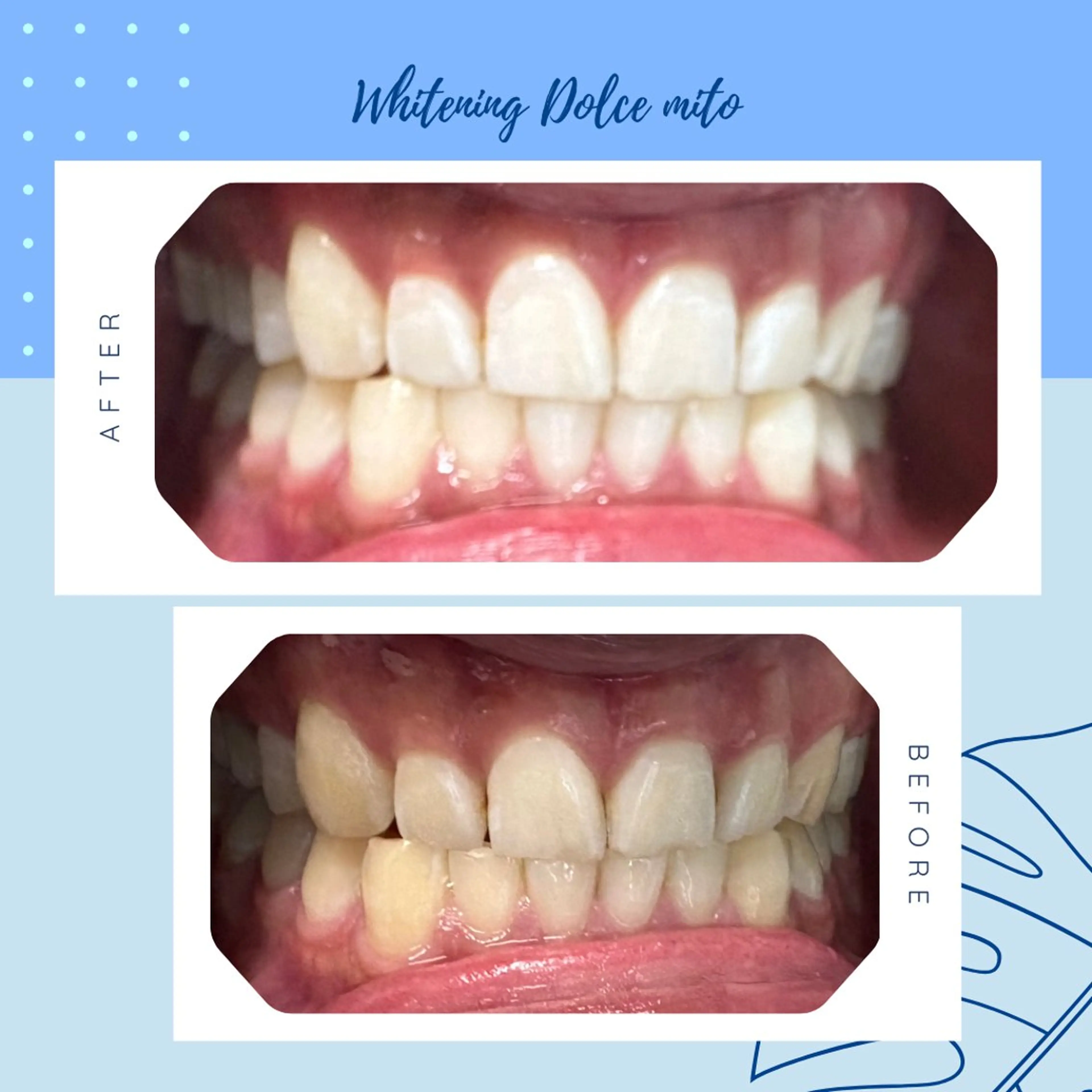 セルフホワイトニング Dolce水戸店のその他イメージ